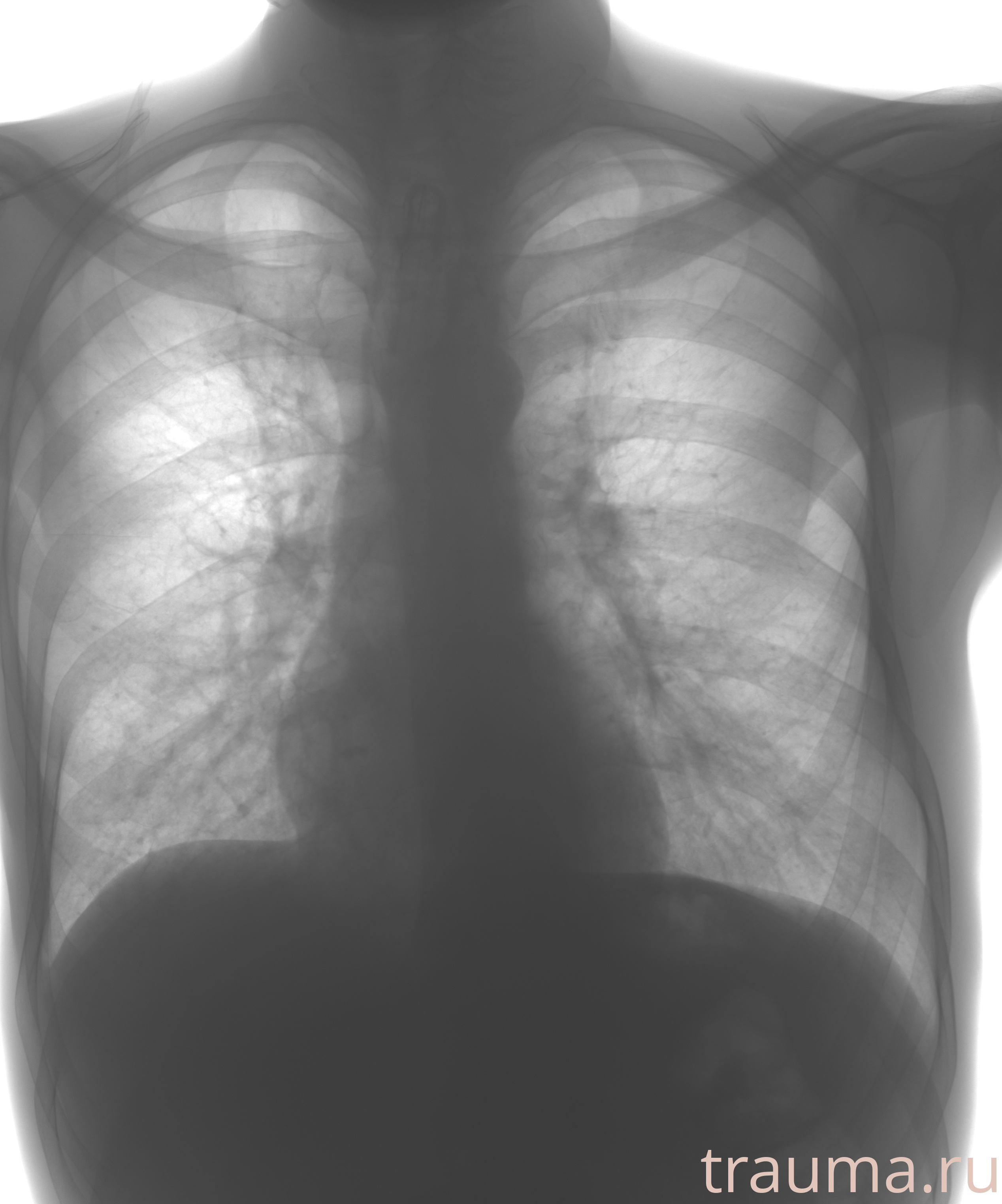 Рентген на дому: по вашему адресу приезжает врач-рентгенолог, травматолог-ортопед с мобильным рентгеновским аппаратом, проводит диагностику травмы или заболевания, делает необходимые рентгенограммы, дает рекомендации по дальнейшему лечению. Получить качественные снимки в домашних условиях возможно благодаря уникальной методике, разработанной МосРентген Центром для института  Склифосовского