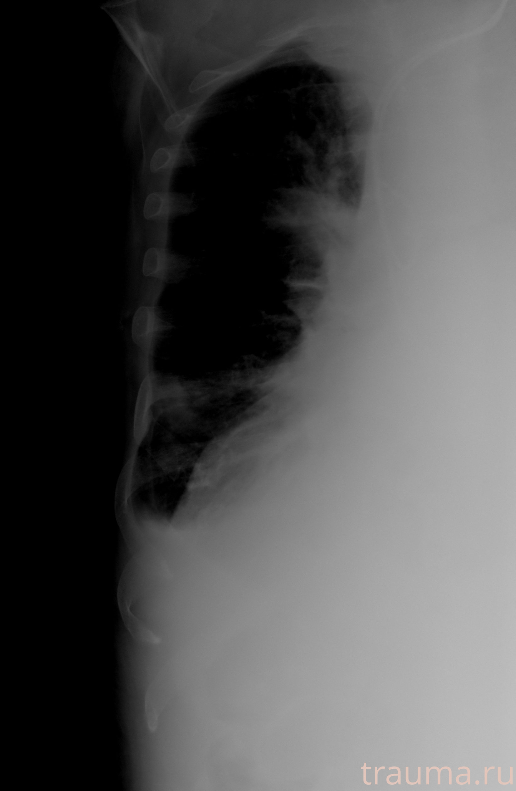 Рентген на дому: по вашему адресу приезжает врач-рентгенолог, травматолог-ортопед с мобильным рентгеновским аппаратом, проводит диагностику травмы или заболевания, делает необходимые рентгенограммы, дает рекомендации по дальнейшему лечению. Получить качественные снимки в домашних условиях возможно благодаря уникальной методике, разработанной МосРентген Центром для института  Склифосовского