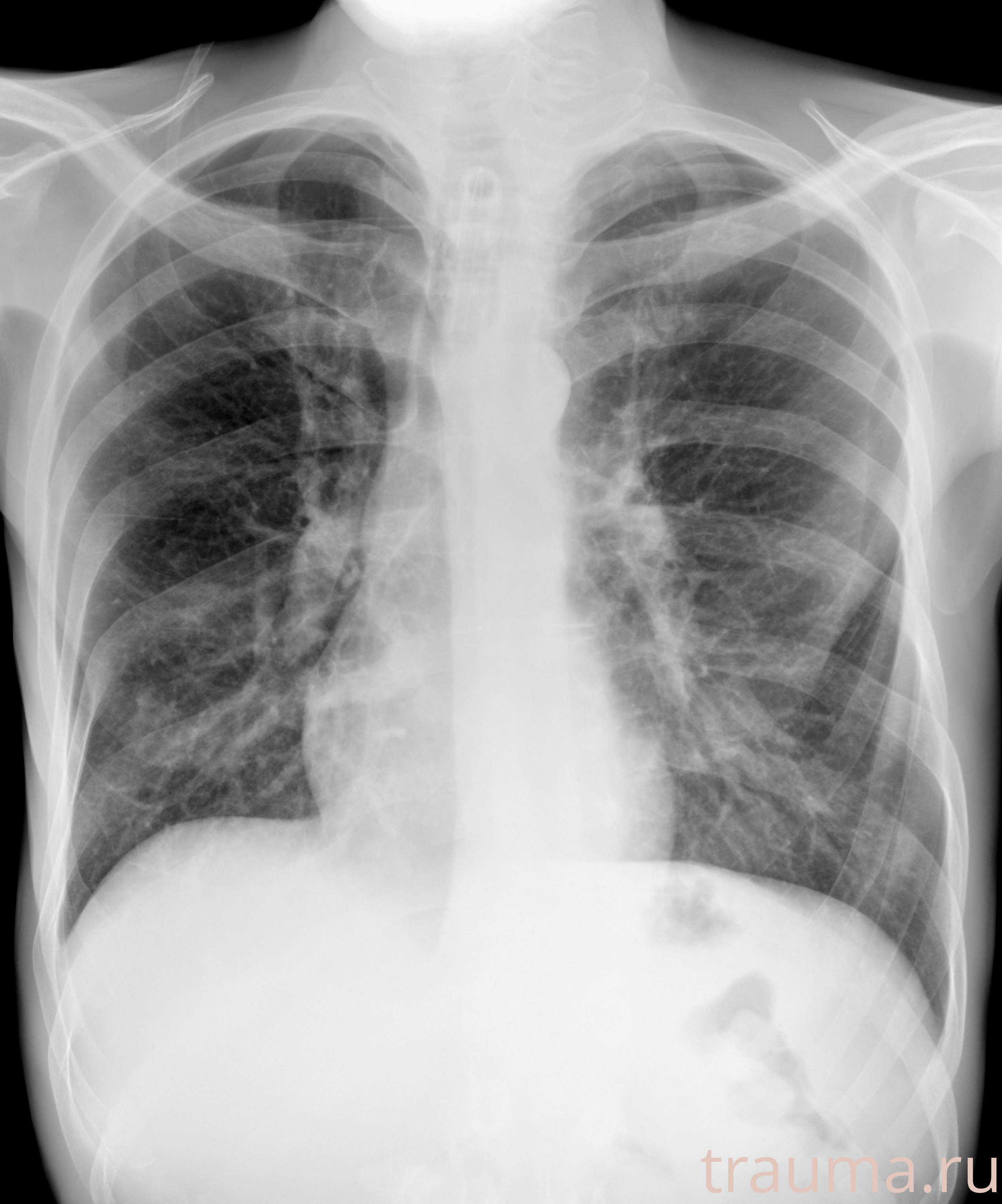 Рентген на дому: по вашему адресу приезжает врач-рентгенолог, травматолог-ортопед с мобильным рентгеновским аппаратом, проводит диагностику травмы или заболевания, делает необходимые рентгенограммы, дает рекомендации по дальнейшему лечению. Получить качественные снимки в домашних условиях возможно благодаря уникальной методике, разработанной МосРентген Центром для института  Склифосовского