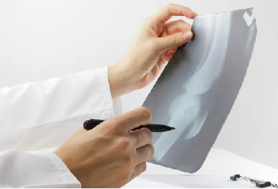 Более 50 новых рентген-аппаратов запустили в Московской области Более 50 новых рентген-аппаратов запустили в Московской области