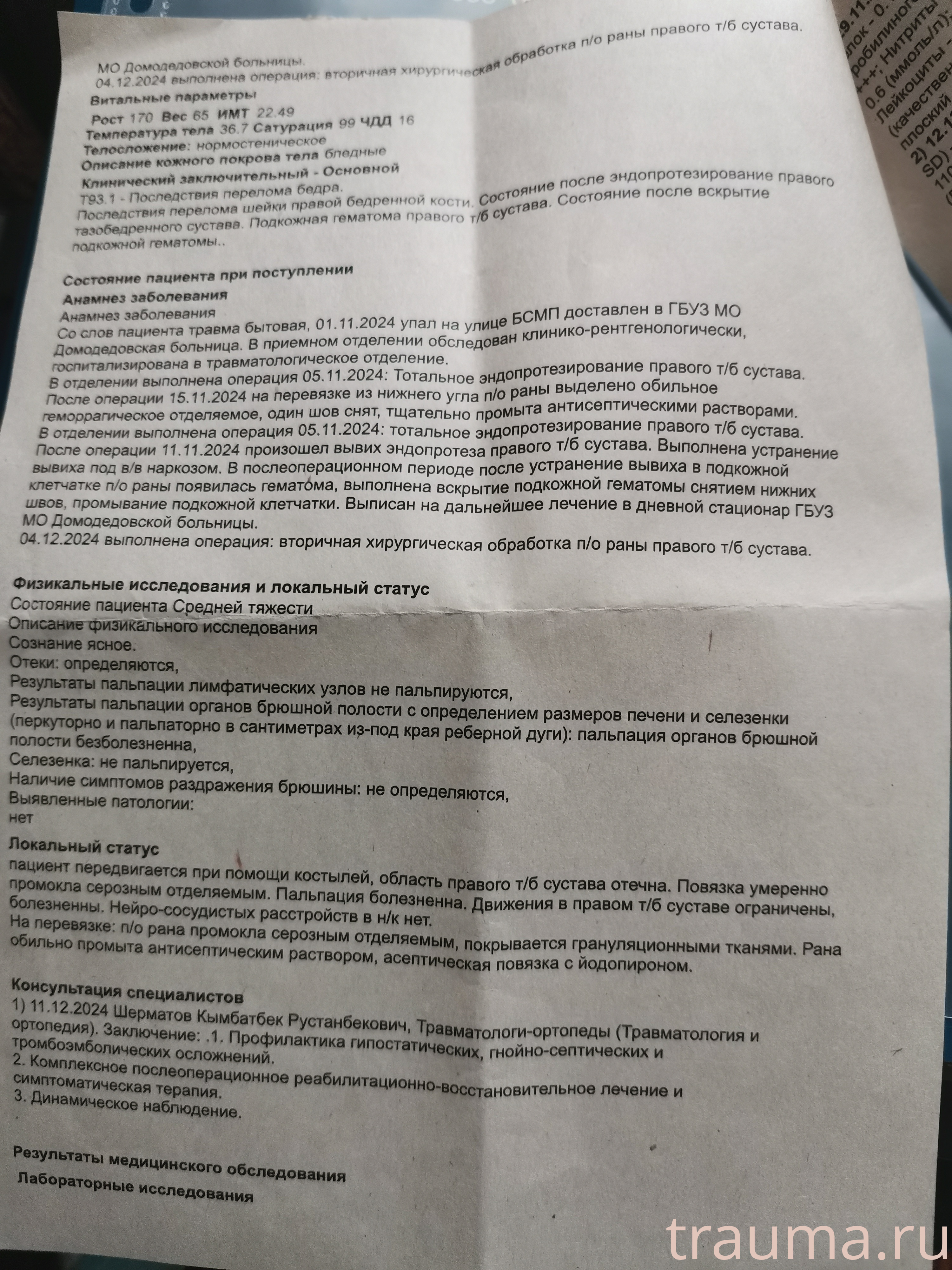 Рентген на дому: по вашему адресу приезжает врач-рентгенолог, травматолог-ортопед с мобильным рентгеновским аппаратом, проводит диагностику травмы или заболевания, делает необходимые рентгенограммы, дает рекомендации по дальнейшему лечению. Получить качественные снимки в домашних условиях возможно благодаря уникальной методике, разработанной МосРентген Центром для института  Склифосовского
