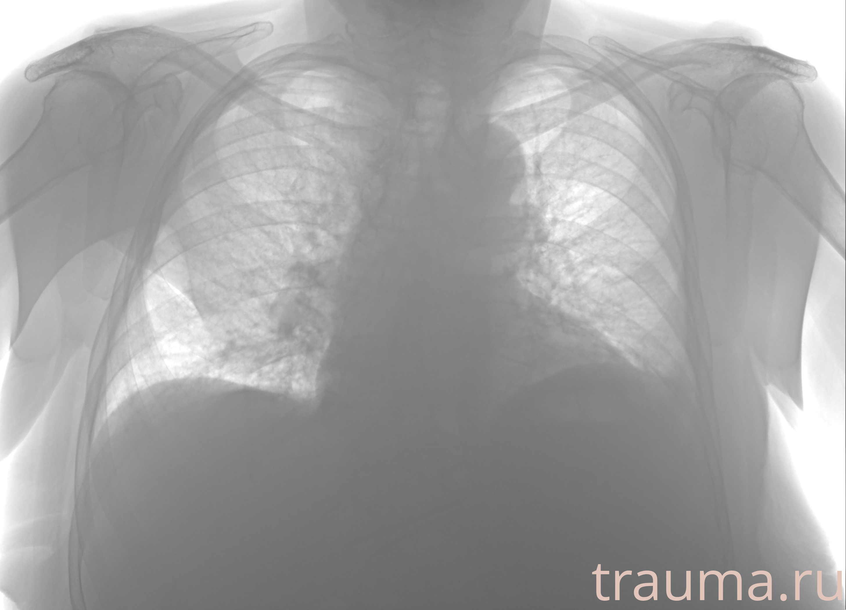 Рентген на дому: по вашему адресу приезжает врач-рентгенолог, травматолог-ортопед с мобильным рентгеновским аппаратом, проводит диагностику травмы или заболевания, делает необходимые рентгенограммы, дает рекомендации по дальнейшему лечению. Получить качественные снимки в домашних условиях возможно благодаря уникальной методике, разработанной МосРентген Центром для института  Склифосовского