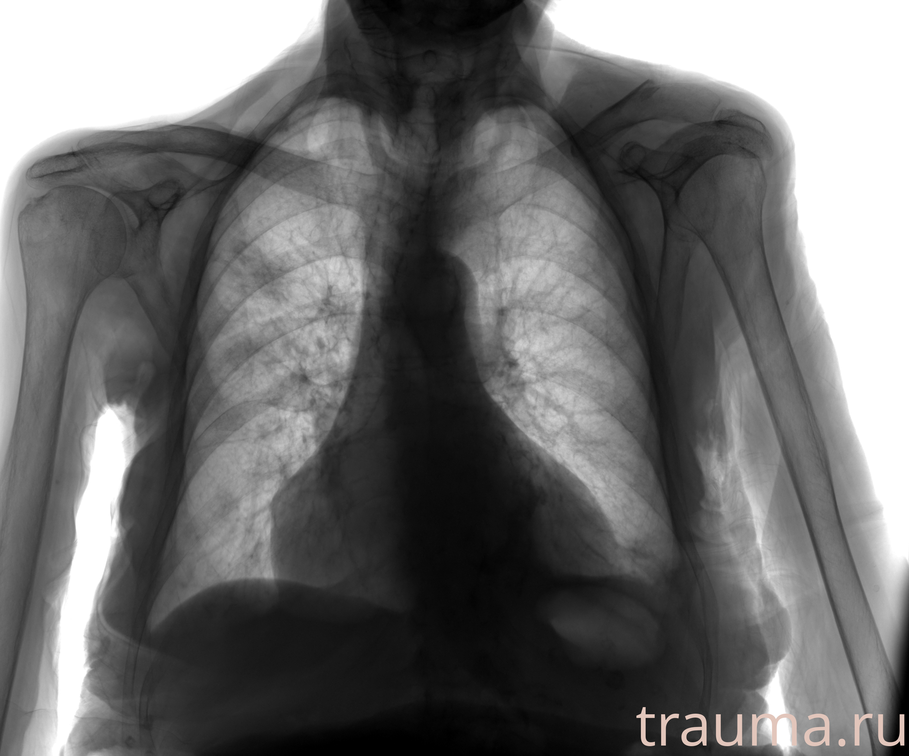 Рентген на дому: по вашему адресу приезжает врач-рентгенолог, травматолог-ортопед с мобильным рентгеновским аппаратом, проводит диагностику травмы или заболевания, делает необходимые рентгенограммы, дает рекомендации по дальнейшему лечению. Получить качественные снимки в домашних условиях возможно благодаря уникальной методике, разработанной МосРентген Центром для института  Склифосовского