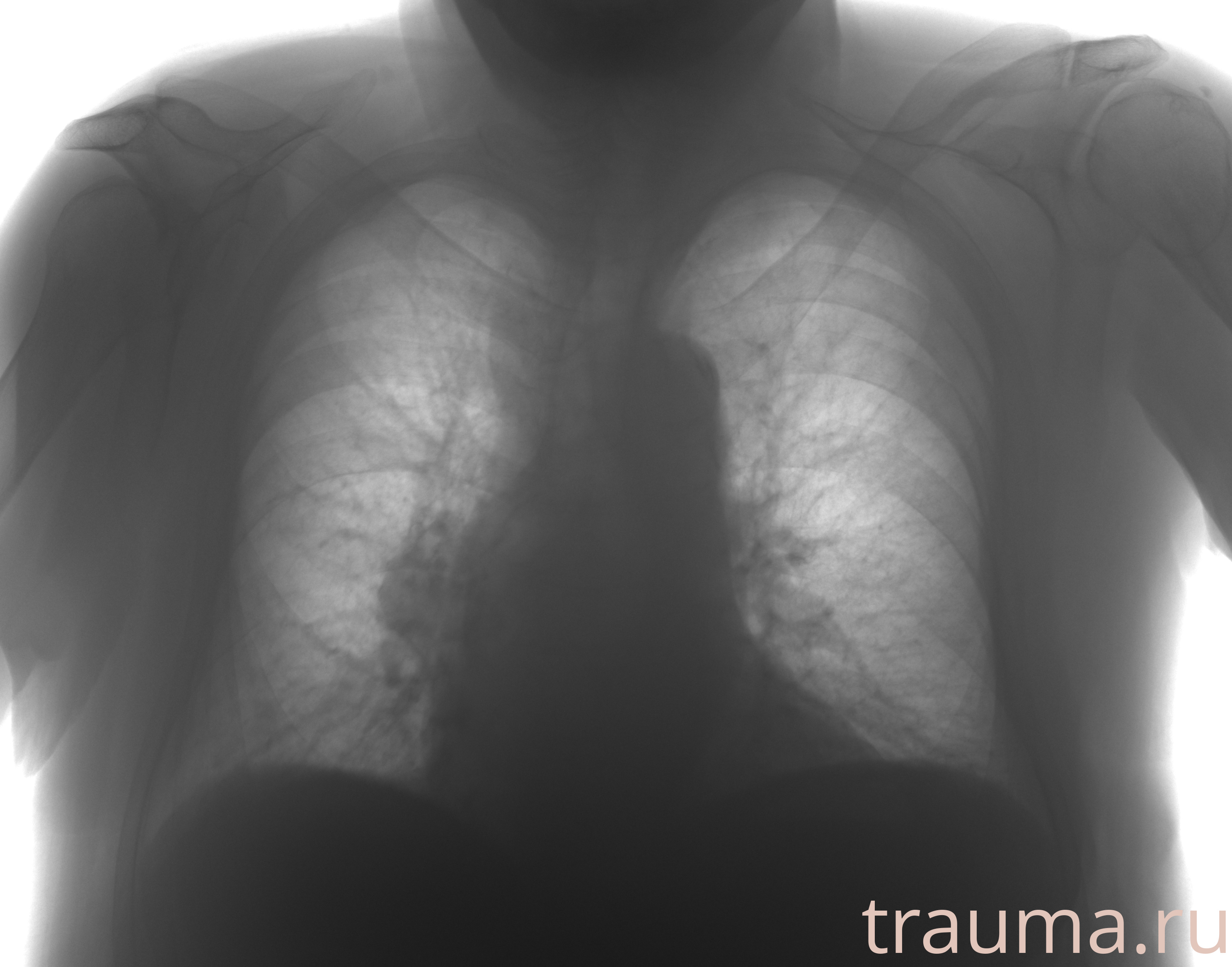 Рентген на дому: по вашему адресу приезжает врач-рентгенолог, травматолог-ортопед с мобильным рентгеновским аппаратом, проводит диагностику травмы или заболевания, делает необходимые рентгенограммы, дает рекомендации по дальнейшему лечению. Получить качественные снимки в домашних условиях возможно благодаря уникальной методике, разработанной МосРентген Центром для института  Склифосовского