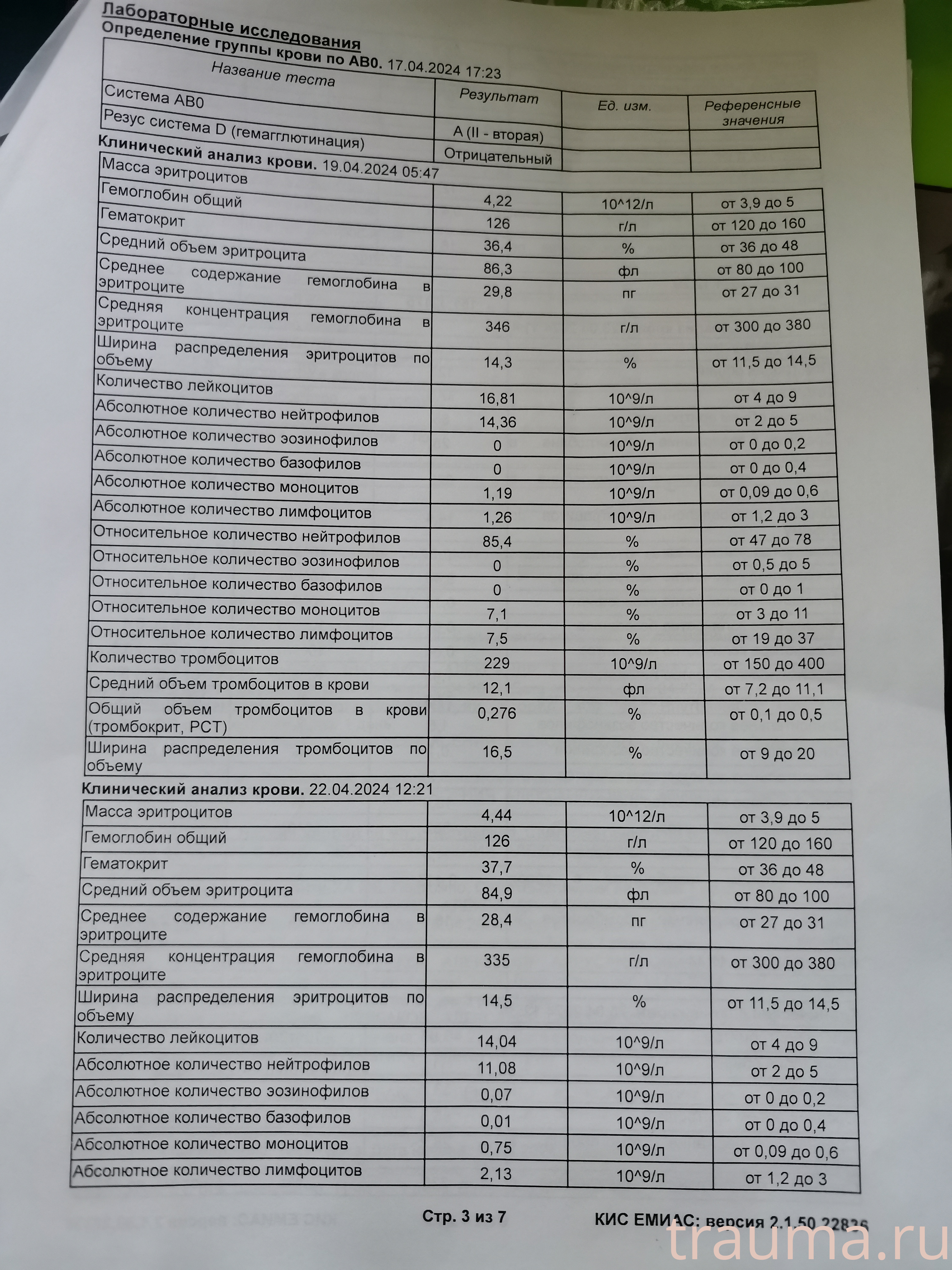 Рентген на дому: по вашему адресу приезжает врач-рентгенолог, травматолог-ортопед с мобильным рентгеновским аппаратом, проводит диагностику травмы или заболевания, делает необходимые рентгенограммы, дает рекомендации по дальнейшему лечению. Получить качественные снимки в домашних условиях возможно благодаря уникальной методике, разработанной МосРентген Центром для института  Склифосовского