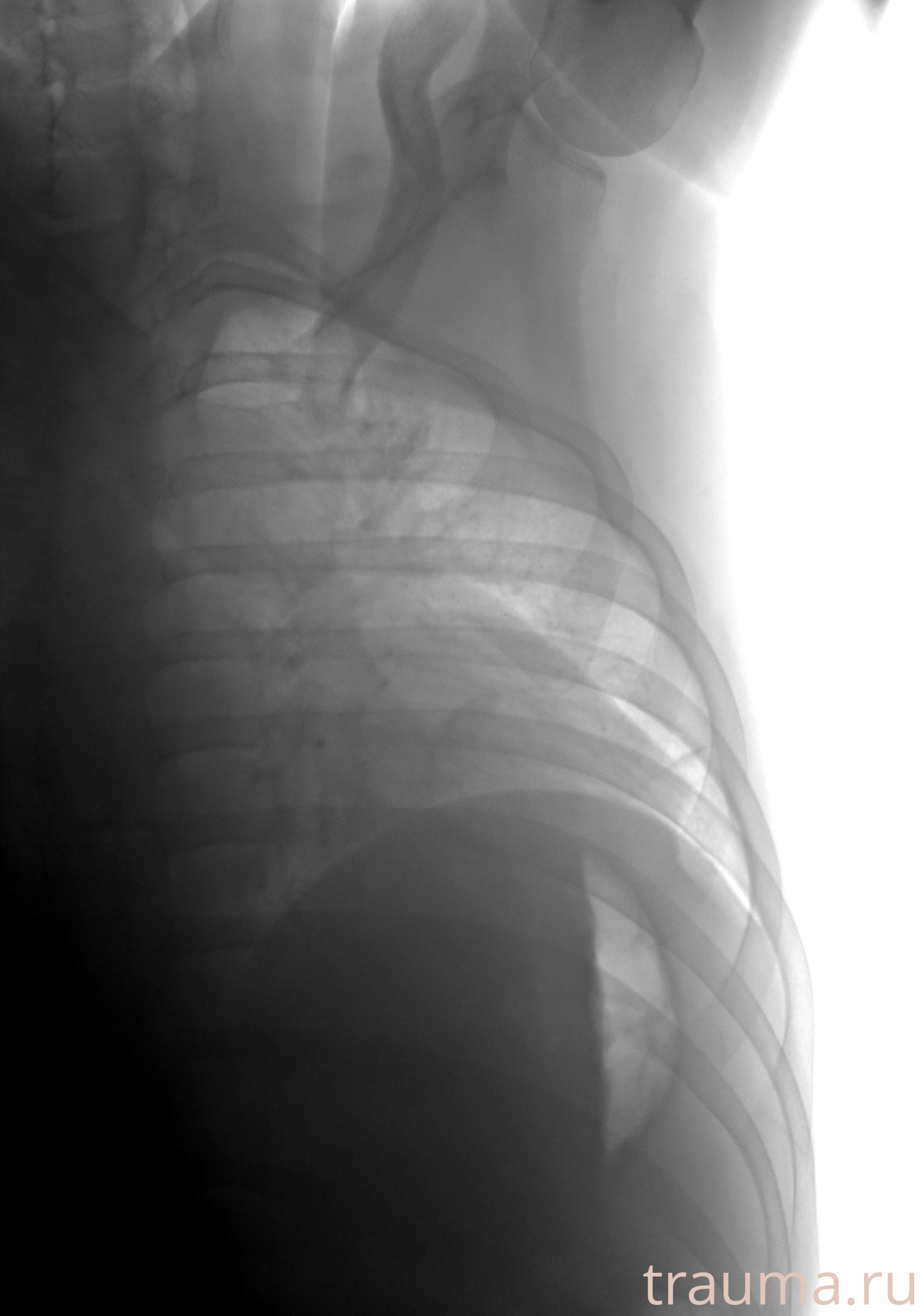 Рентген на дому: по вашему адресу приезжает врач-рентгенолог, травматолог-ортопед с мобильным рентгеновским аппаратом, проводит диагностику травмы или заболевания, делает необходимые рентгенограммы, дает рекомендации по дальнейшему лечению. Получить качественные снимки в домашних условиях возможно благодаря уникальной методике, разработанной МосРентген Центром для института  Склифосовского