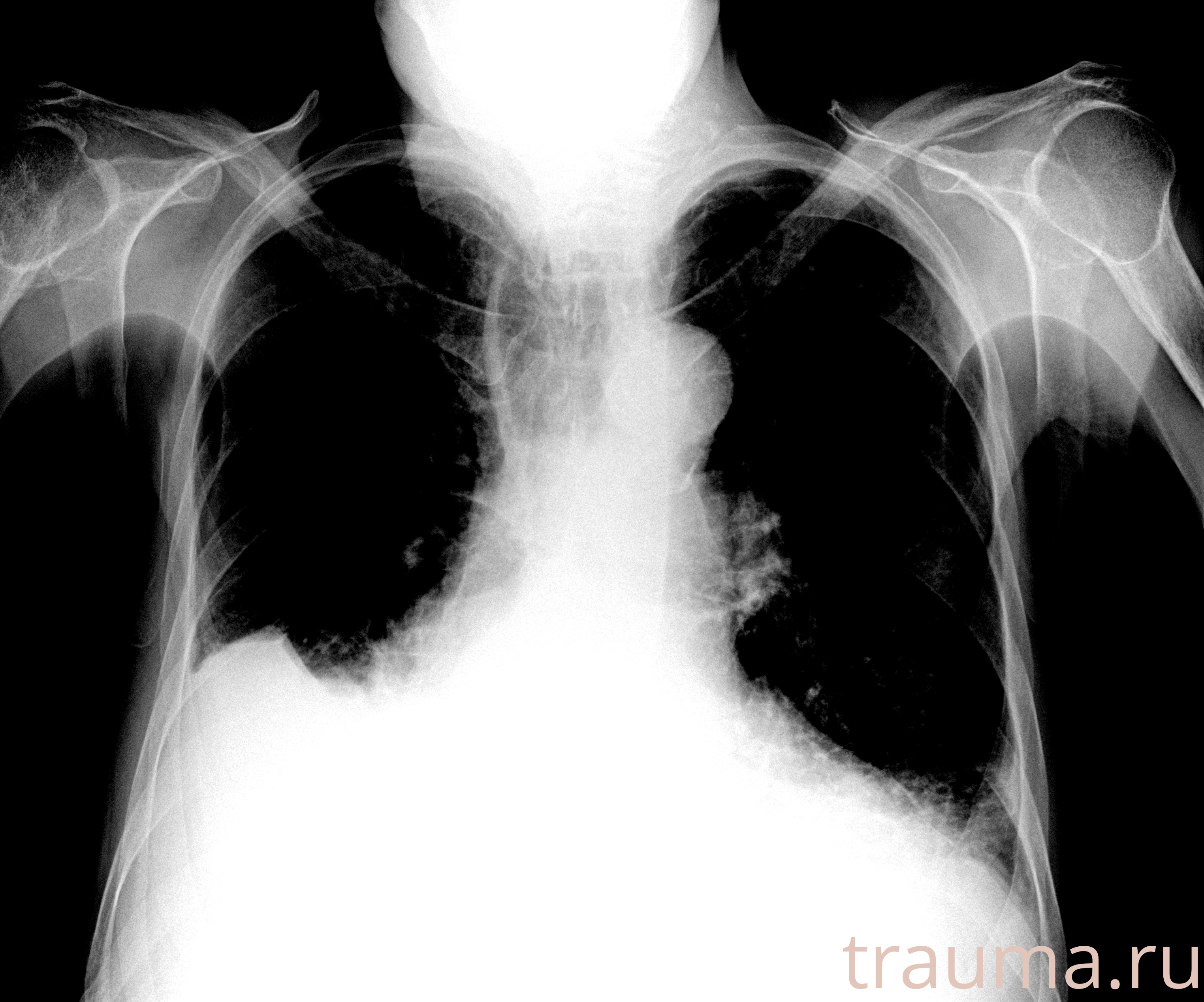 Рентген на дому: по вашему адресу приезжает врач-рентгенолог, травматолог-ортопед с мобильным рентгеновским аппаратом, проводит диагностику травмы или заболевания, делает необходимые рентгенограммы, дает рекомендации по дальнейшему лечению. Получить качественные снимки в домашних условиях возможно благодаря уникальной методике, разработанной МосРентген Центром для института  Склифосовского