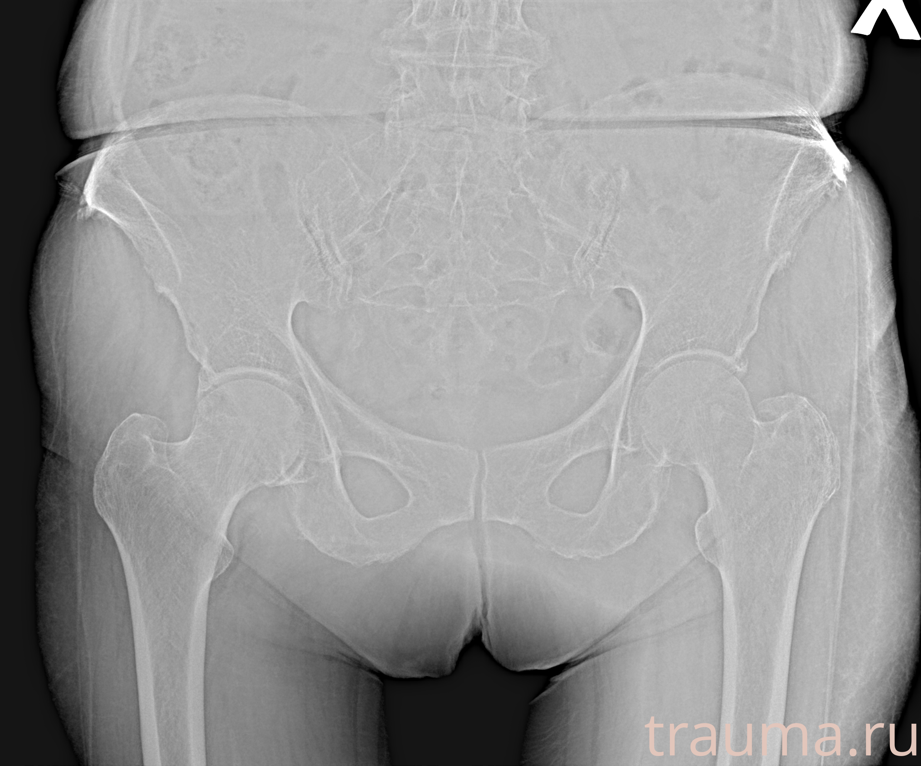 Рентген на дому: по вашему адресу приезжает врач-рентгенолог, травматолог-ортопед с мобильным рентгеновским аппаратом, проводит диагностику травмы или заболевания, делает необходимые рентгенограммы, дает рекомендации по дальнейшему лечению. Получить качественные снимки в домашних условиях возможно благодаря уникальной методике, разработанной МосРентген Центром для института  Склифосовского