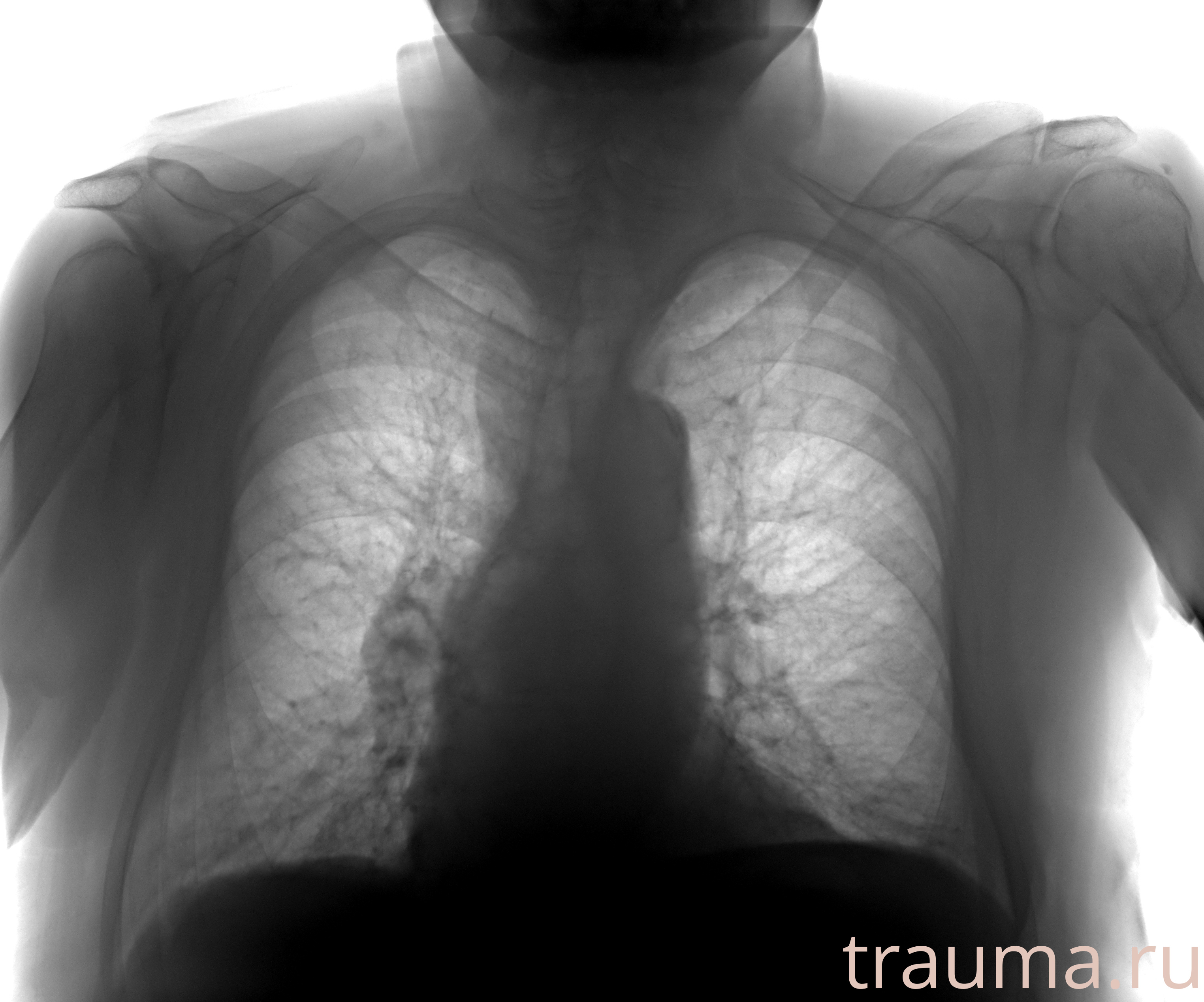 Рентген на дому: по вашему адресу приезжает врач-рентгенолог, травматолог-ортопед с мобильным рентгеновским аппаратом, проводит диагностику травмы или заболевания, делает необходимые рентгенограммы, дает рекомендации по дальнейшему лечению. Получить качественные снимки в домашних условиях возможно благодаря уникальной методике, разработанной МосРентген Центром для института  Склифосовского