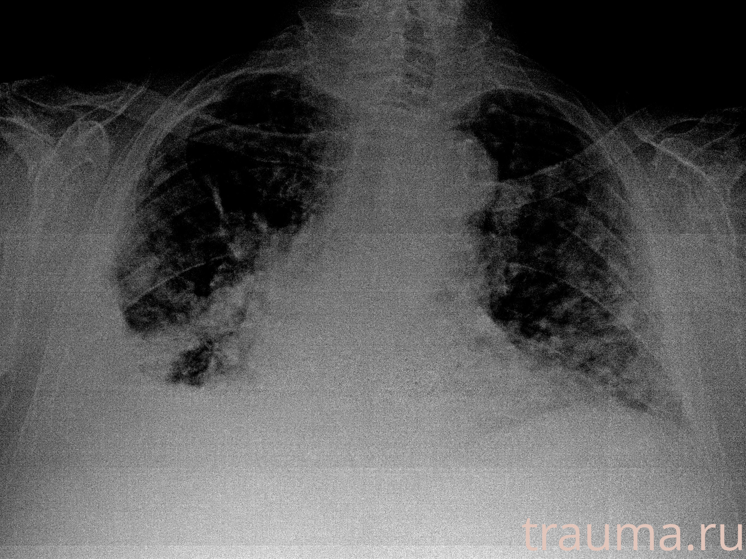 Рентген на дому: по вашему адресу приезжает врач-рентгенолог, травматолог-ортопед с мобильным рентгеновским аппаратом, проводит диагностику травмы или заболевания, делает необходимые рентгенограммы, дает рекомендации по дальнейшему лечению. Получить качественные снимки в домашних условиях возможно благодаря уникальной методике, разработанной МосРентген Центром для института  Склифосовского