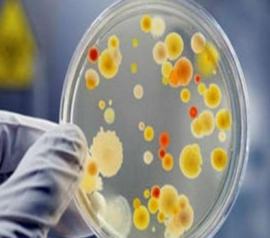 Влияние гена лейкоцидина Пантона – Валентайна Staphylococcus aureus на течение инфекционного процесса у пациентов ортопедического профиля 


 