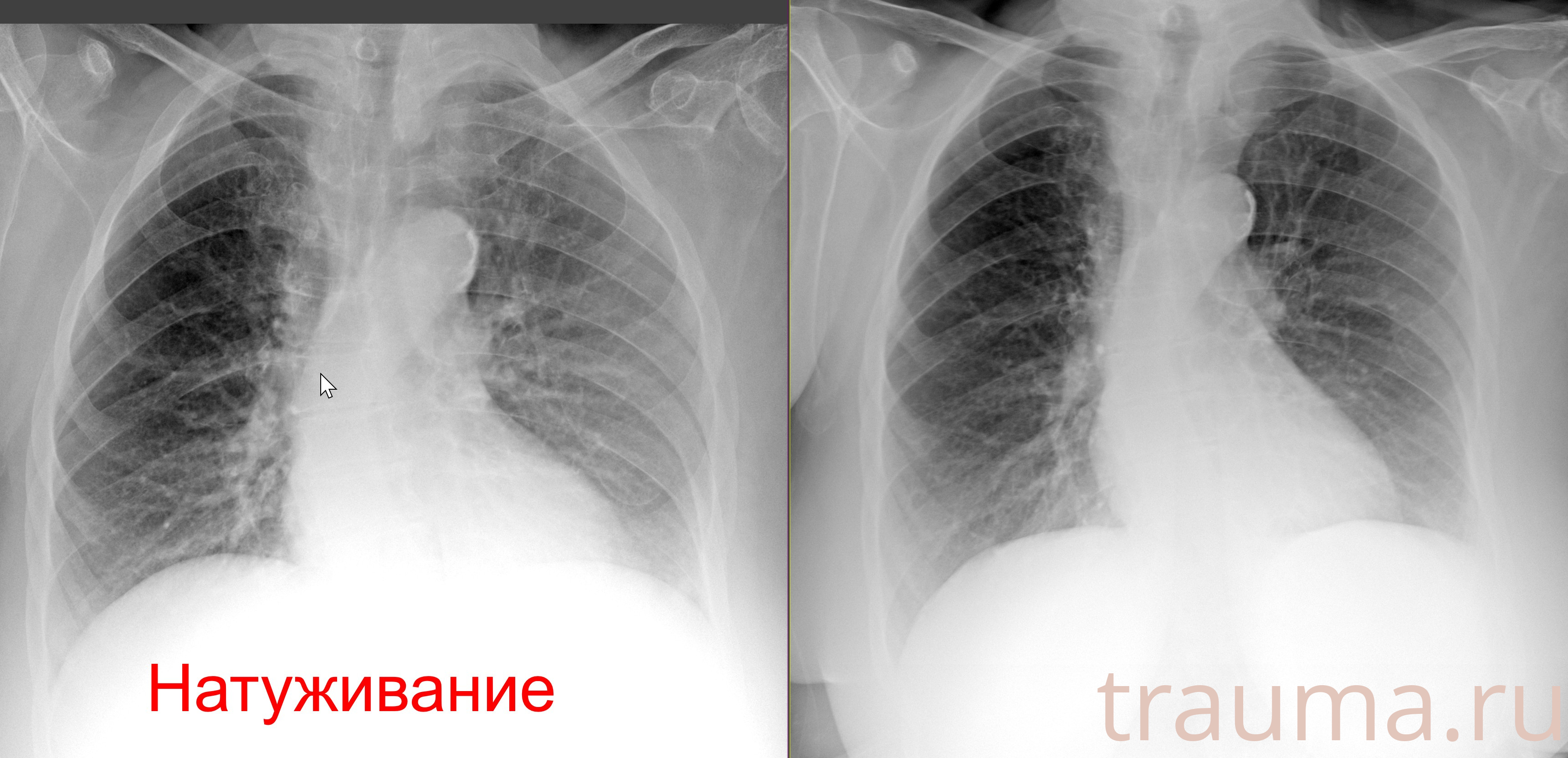 Рентген на дому: по вашему адресу приезжает врач-рентгенолог, травматолог-ортопед с мобильным рентгеновским аппаратом, проводит диагностику травмы или заболевания, делает необходимые рентгенограммы, дает рекомендации по дальнейшему лечению. Получить качественные снимки в домашних условиях возможно благодаря уникальной методике, разработанной МосРентген Центром для института  Склифосовского