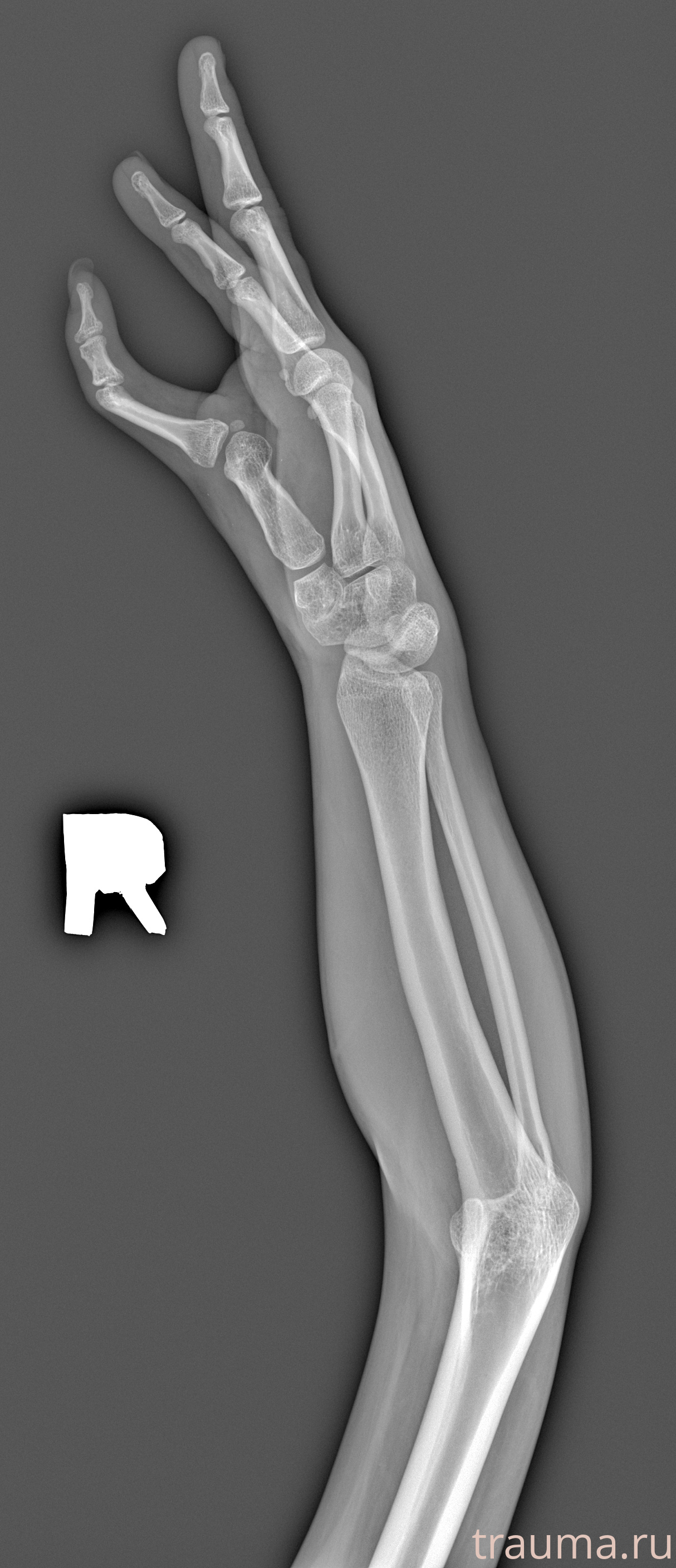 Рентген на дому: по вашему адресу приезжает врач-рентгенолог, травматолог-ортопед с мобильным рентгеновским аппаратом, проводит диагностику травмы или заболевания, делает необходимые рентгенограммы, дает рекомендации по дальнейшему лечению. Получить качественные снимки в домашних условиях возможно благодаря уникальной методике, разработанной МосРентген Центром для института  Склифосовского