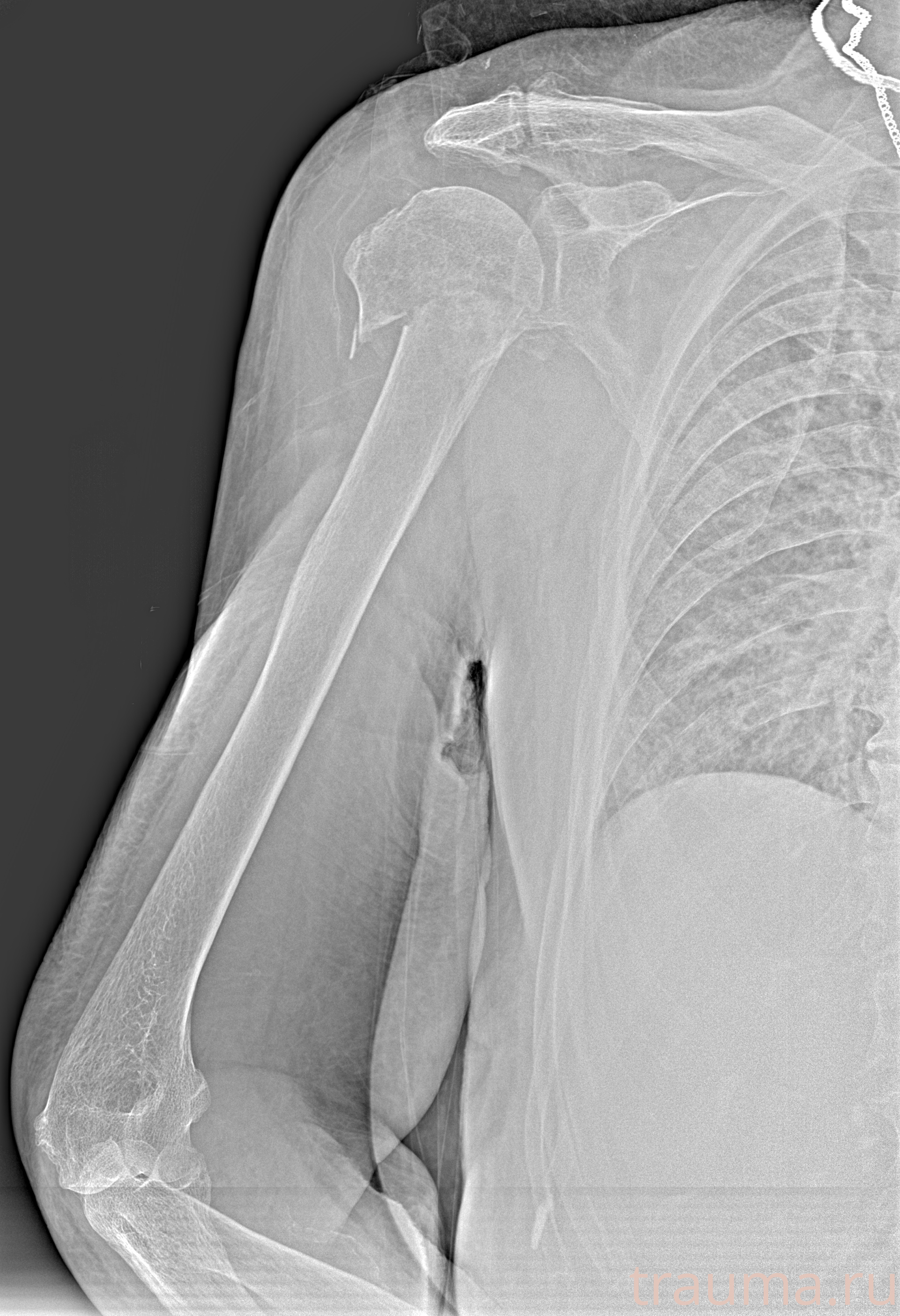 Рентген на дому: по вашему адресу приезжает врач-рентгенолог, травматолог-ортопед с мобильным рентгеновским аппаратом, проводит диагностику травмы или заболевания, делает необходимые рентгенограммы, дает рекомендации по дальнейшему лечению. Получить качественные снимки в домашних условиях возможно благодаря уникальной методике, разработанной МосРентген Центром для института  Склифосовского
