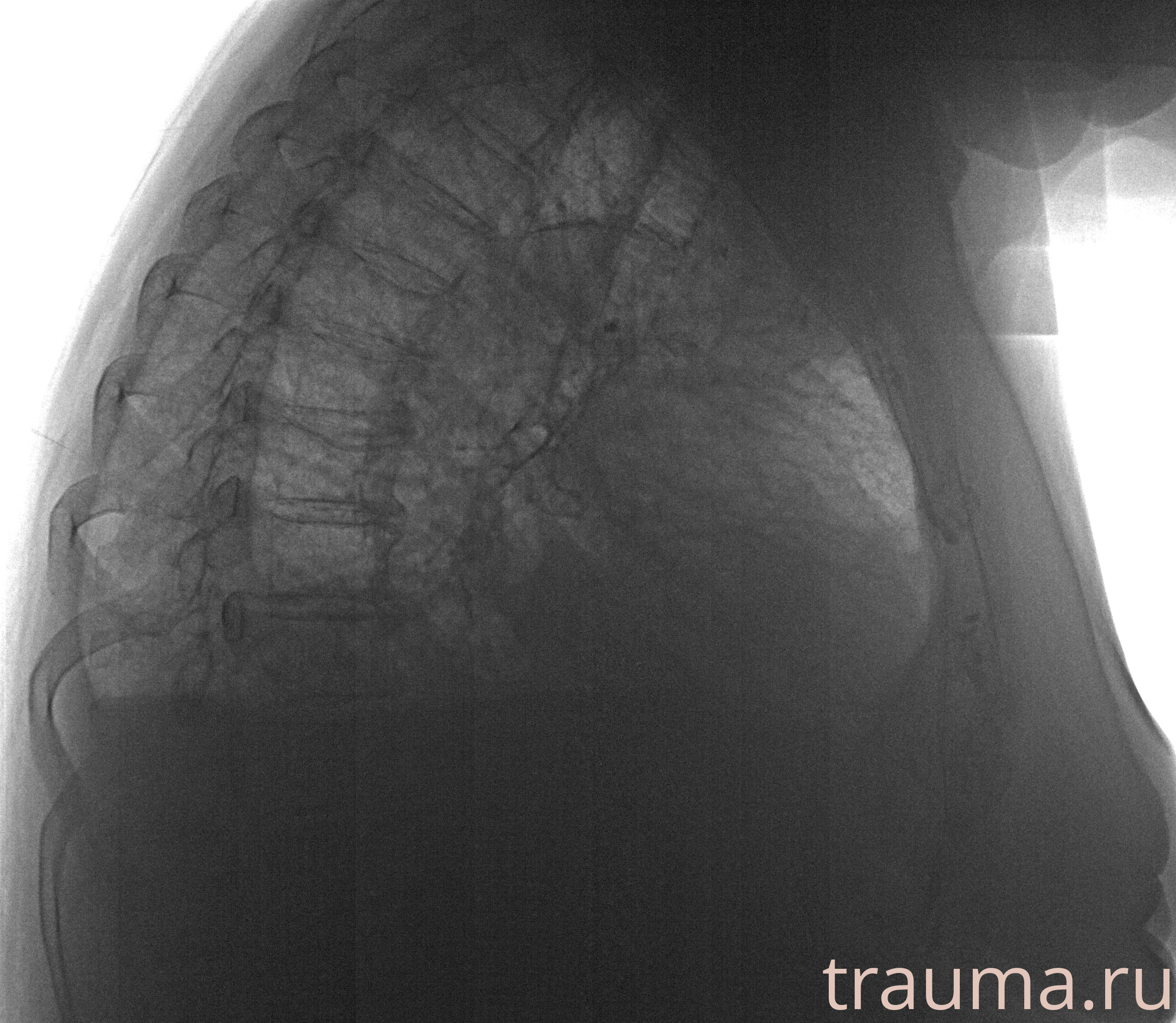 Рентген на дому: по вашему адресу приезжает врач-рентгенолог, травматолог-ортопед с мобильным рентгеновским аппаратом, проводит диагностику травмы или заболевания, делает необходимые рентгенограммы, дает рекомендации по дальнейшему лечению. Получить качественные снимки в домашних условиях возможно благодаря уникальной методике, разработанной МосРентген Центром для института  Склифосовского