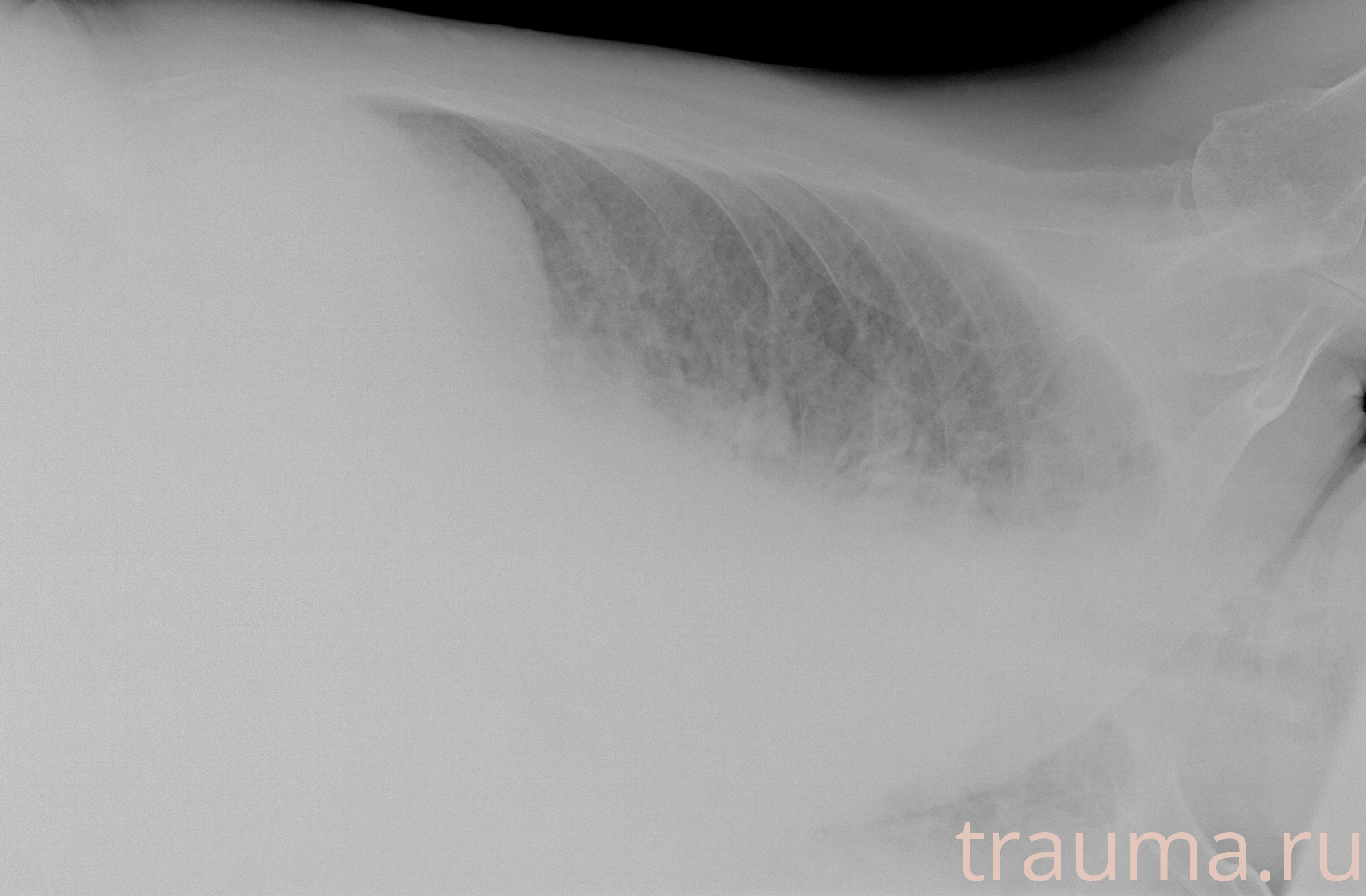 Рентген на дому: по вашему адресу приезжает врач-рентгенолог, травматолог-ортопед с мобильным рентгеновским аппаратом, проводит диагностику травмы или заболевания, делает необходимые рентгенограммы, дает рекомендации по дальнейшему лечению. Получить качественные снимки в домашних условиях возможно благодаря уникальной методике, разработанной МосРентген Центром для института  Склифосовского