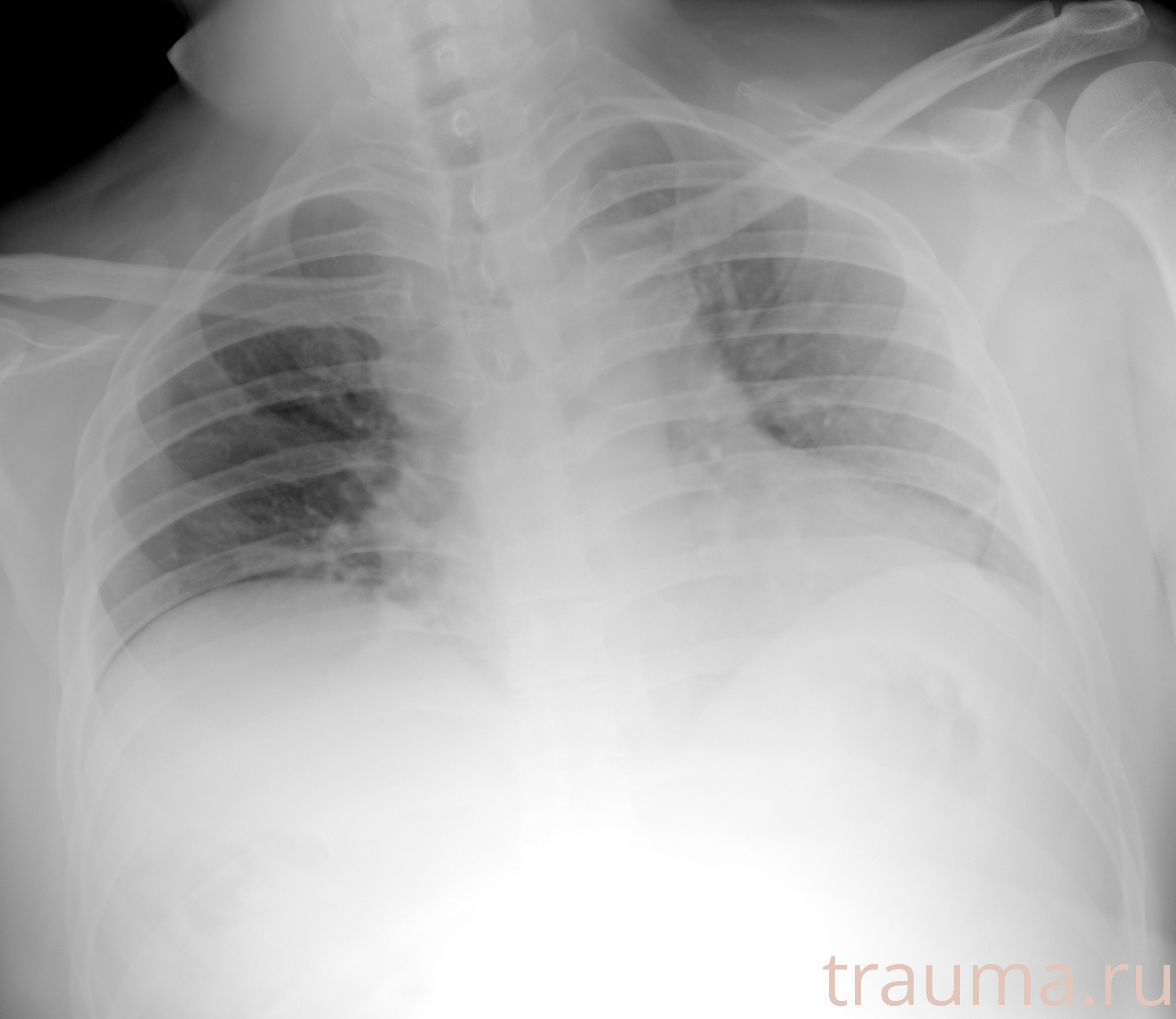 Рентген на дому: по вашему адресу приезжает врач-рентгенолог, травматолог-ортопед с мобильным рентгеновским аппаратом, проводит диагностику травмы или заболевания, делает необходимые рентгенограммы, дает рекомендации по дальнейшему лечению. Получить качественные снимки в домашних условиях возможно благодаря уникальной методике, разработанной МосРентген Центром для института  Склифосовского