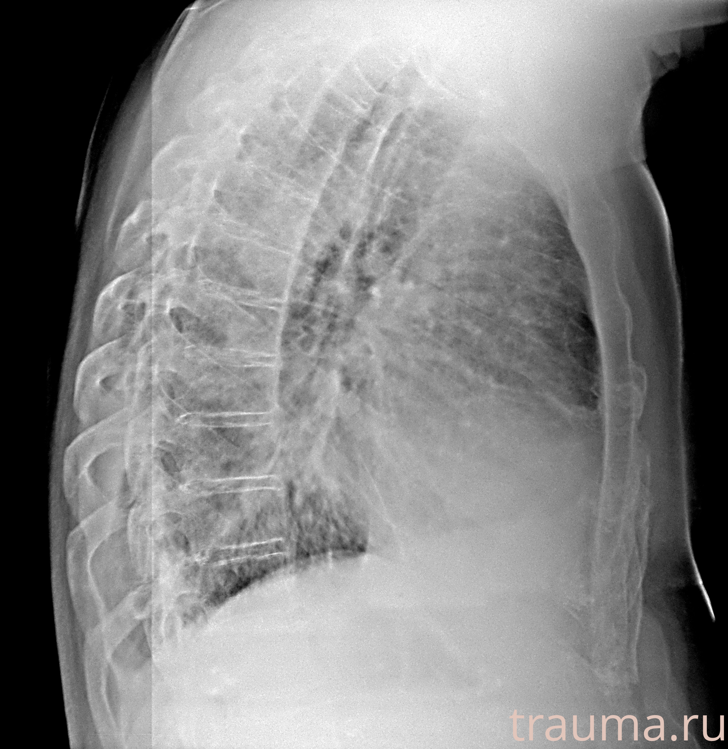 Рентген на дому: по вашему адресу приезжает врач-рентгенолог, травматолог-ортопед с мобильным рентгеновским аппаратом, проводит диагностику травмы или заболевания, делает необходимые рентгенограммы, дает рекомендации по дальнейшему лечению. Получить качественные снимки в домашних условиях возможно благодаря уникальной методике, разработанной МосРентген Центром для института  Склифосовского