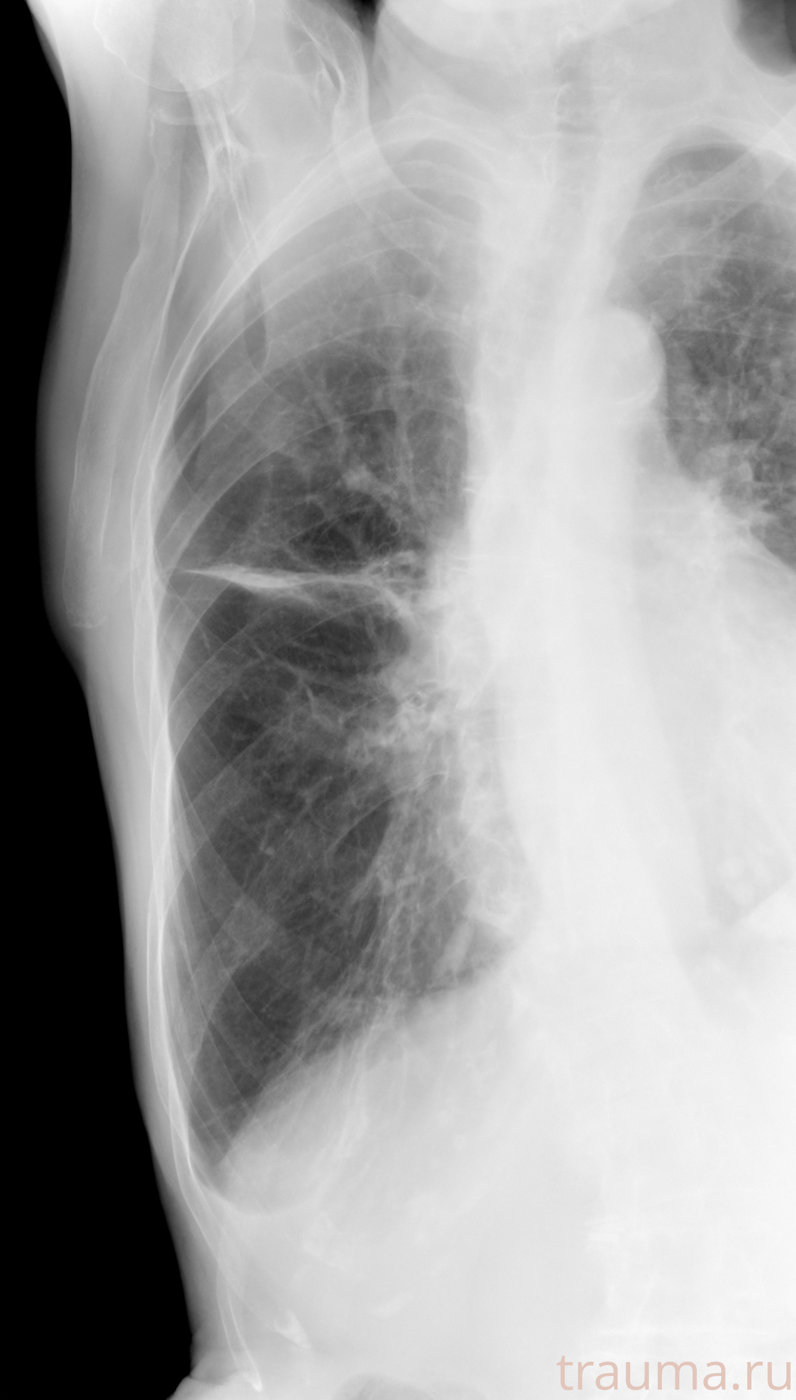 Рентген на дому: по вашему адресу приезжает врач-рентгенолог, травматолог-ортопед с мобильным рентгеновским аппаратом, проводит диагностику травмы или заболевания, делает необходимые рентгенограммы, дает рекомендации по дальнейшему лечению. Получить качественные снимки в домашних условиях возможно благодаря уникальной методике, разработанной МосРентген Центром для института  Склифосовского