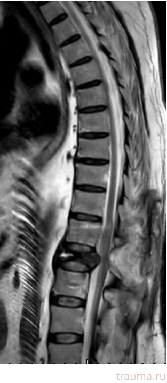 Рентген на дому: по вашему адресу приезжает врач-рентгенолог, травматолог-ортопед с мобильным рентгеновским аппаратом, проводит диагностику травмы или заболевания, делает необходимые рентгенограммы, дает рекомендации по дальнейшему лечению. Получить качественные снимки в домашних условиях возможно благодаря уникальной методике, разработанной МосРентген Центром для института  Склифосовского
