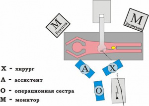 Методы оптимизации лучевых нагрузок на персонал при рентгеноэндоскопических операциях в урологии
Методы оптимизации лучевых нагрузок на персонал при рентгеноэндоскопических операциях в урологии