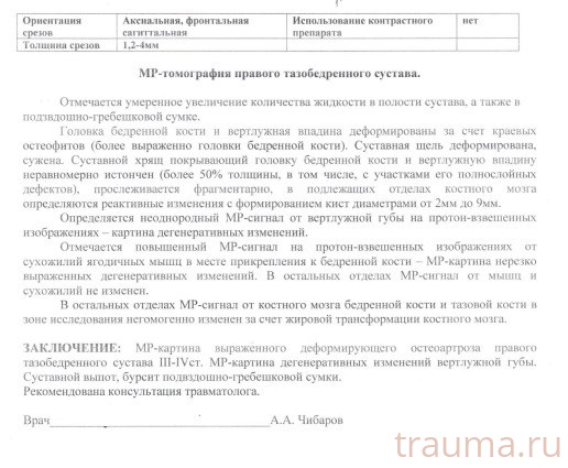 Рентген на дому: по вашему адресу приезжает врач-рентгенолог, травматолог-ортопед с мобильным рентгеновским аппаратом, проводит диагностику травмы или заболевания, делает необходимые рентгенограммы, дает рекомендации по дальнейшему лечению. Получить качественные снимки в домашних условиях возможно благодаря уникальной методике, разработанной МосРентген Центром для института  Склифосовского