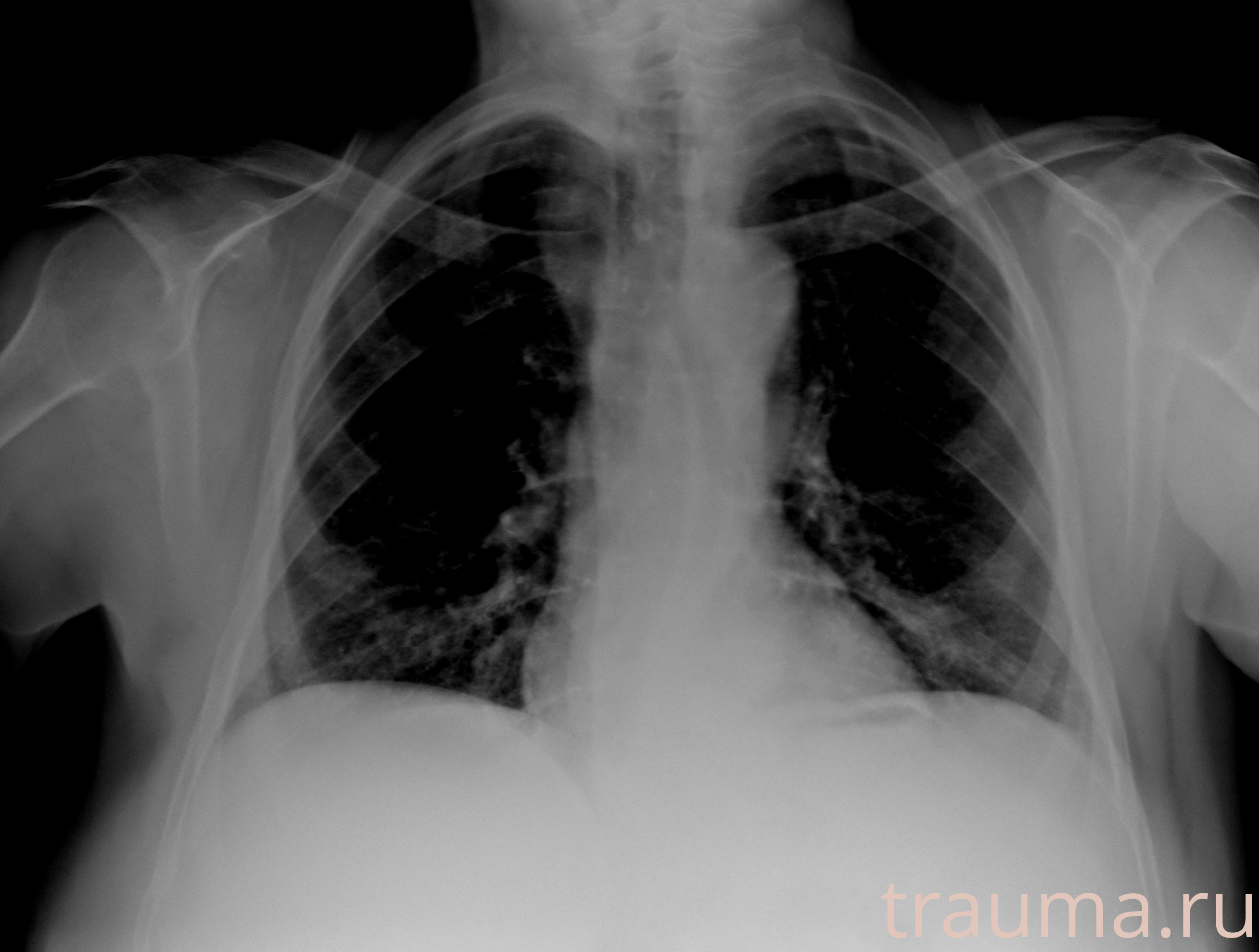 Рентген на дому: по вашему адресу приезжает врач-рентгенолог, травматолог-ортопед с мобильным рентгеновским аппаратом, проводит диагностику травмы или заболевания, делает необходимые рентгенограммы, дает рекомендации по дальнейшему лечению. Получить качественные снимки в домашних условиях возможно благодаря уникальной методике, разработанной МосРентген Центром для института  Склифосовского