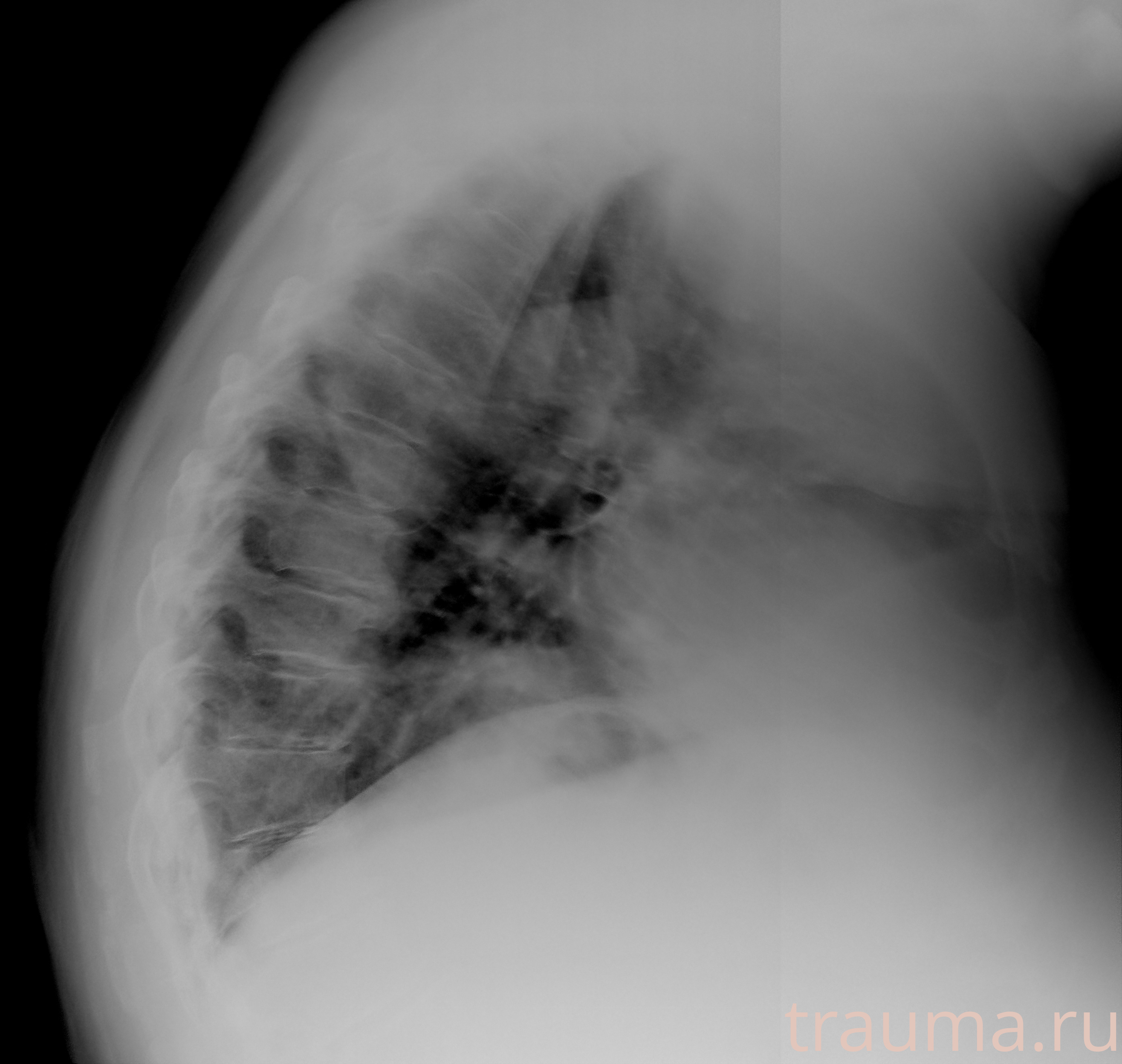 Рентген на дому: по вашему адресу приезжает врач-рентгенолог, травматолог-ортопед с мобильным рентгеновским аппаратом, проводит диагностику травмы или заболевания, делает необходимые рентгенограммы, дает рекомендации по дальнейшему лечению. Получить качественные снимки в домашних условиях возможно благодаря уникальной методике, разработанной МосРентген Центром для института  Склифосовского