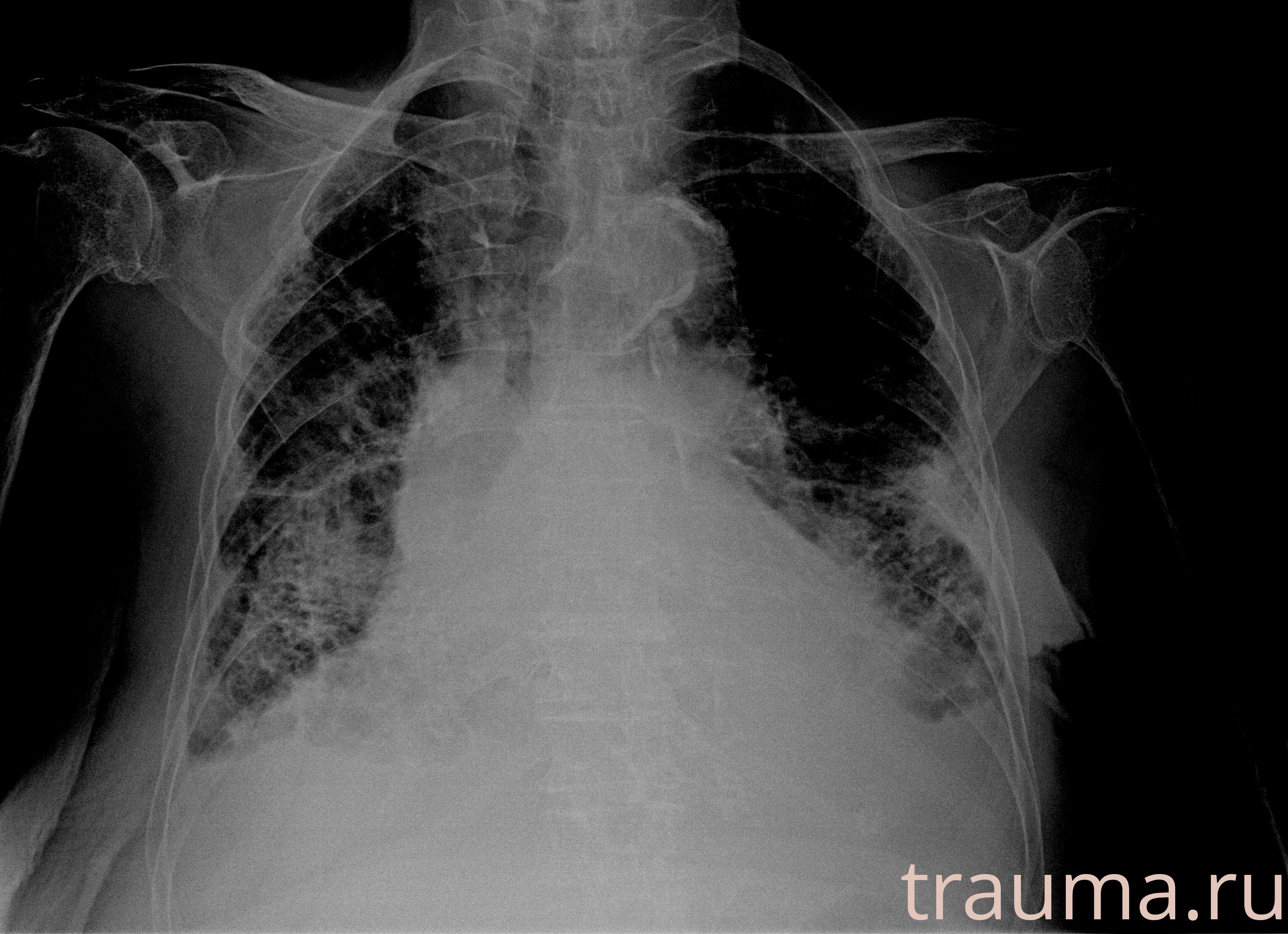 Рентген на дому: по вашему адресу приезжает врач-рентгенолог, травматолог-ортопед с мобильным рентгеновским аппаратом, проводит диагностику травмы или заболевания, делает необходимые рентгенограммы, дает рекомендации по дальнейшему лечению. Получить качественные снимки в домашних условиях возможно благодаря уникальной методике, разработанной МосРентген Центром для института  Склифосовского