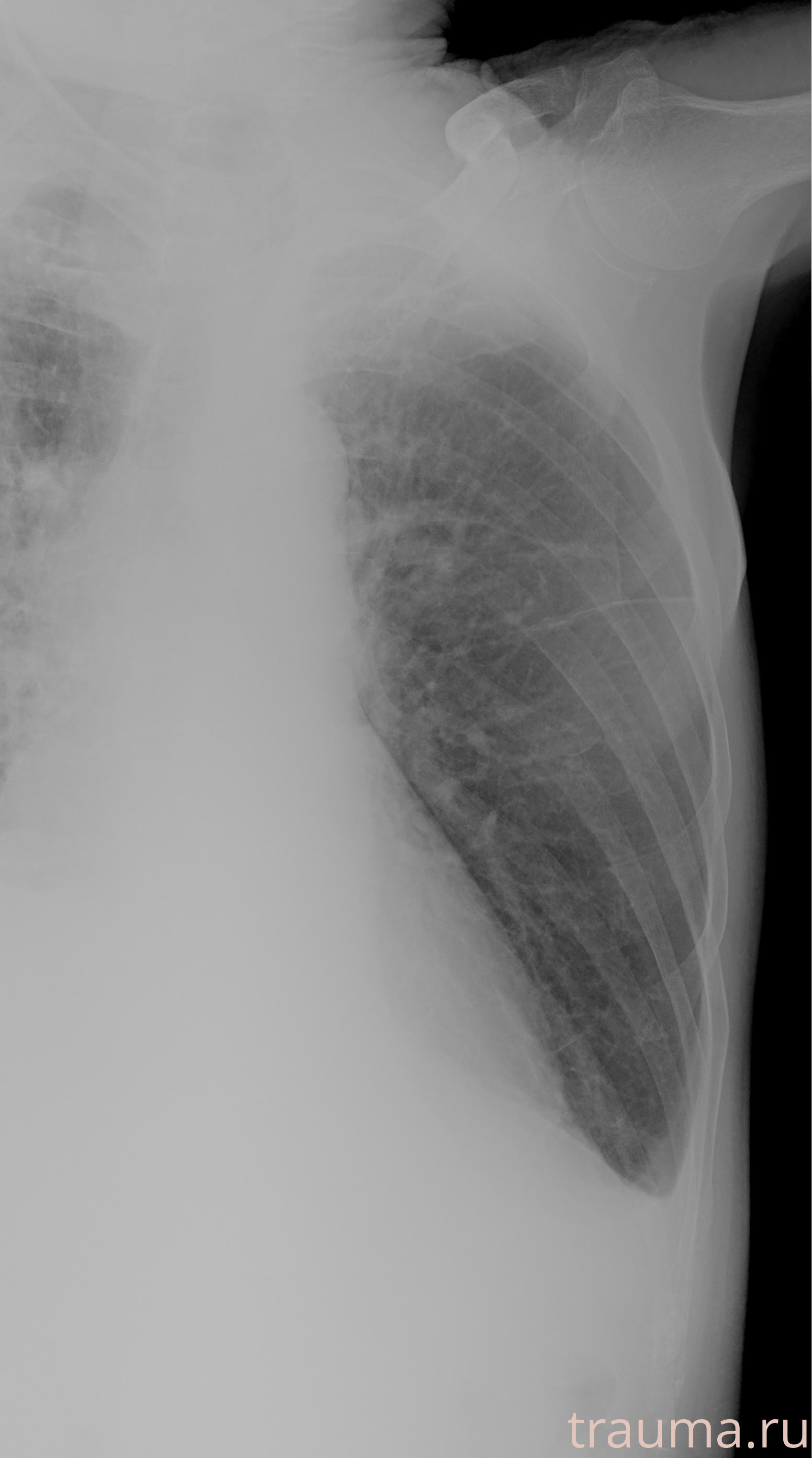 Рентген на дому: по вашему адресу приезжает врач-рентгенолог, травматолог-ортопед с мобильным рентгеновским аппаратом, проводит диагностику травмы или заболевания, делает необходимые рентгенограммы, дает рекомендации по дальнейшему лечению. Получить качественные снимки в домашних условиях возможно благодаря уникальной методике, разработанной МосРентген Центром для института  Склифосовского