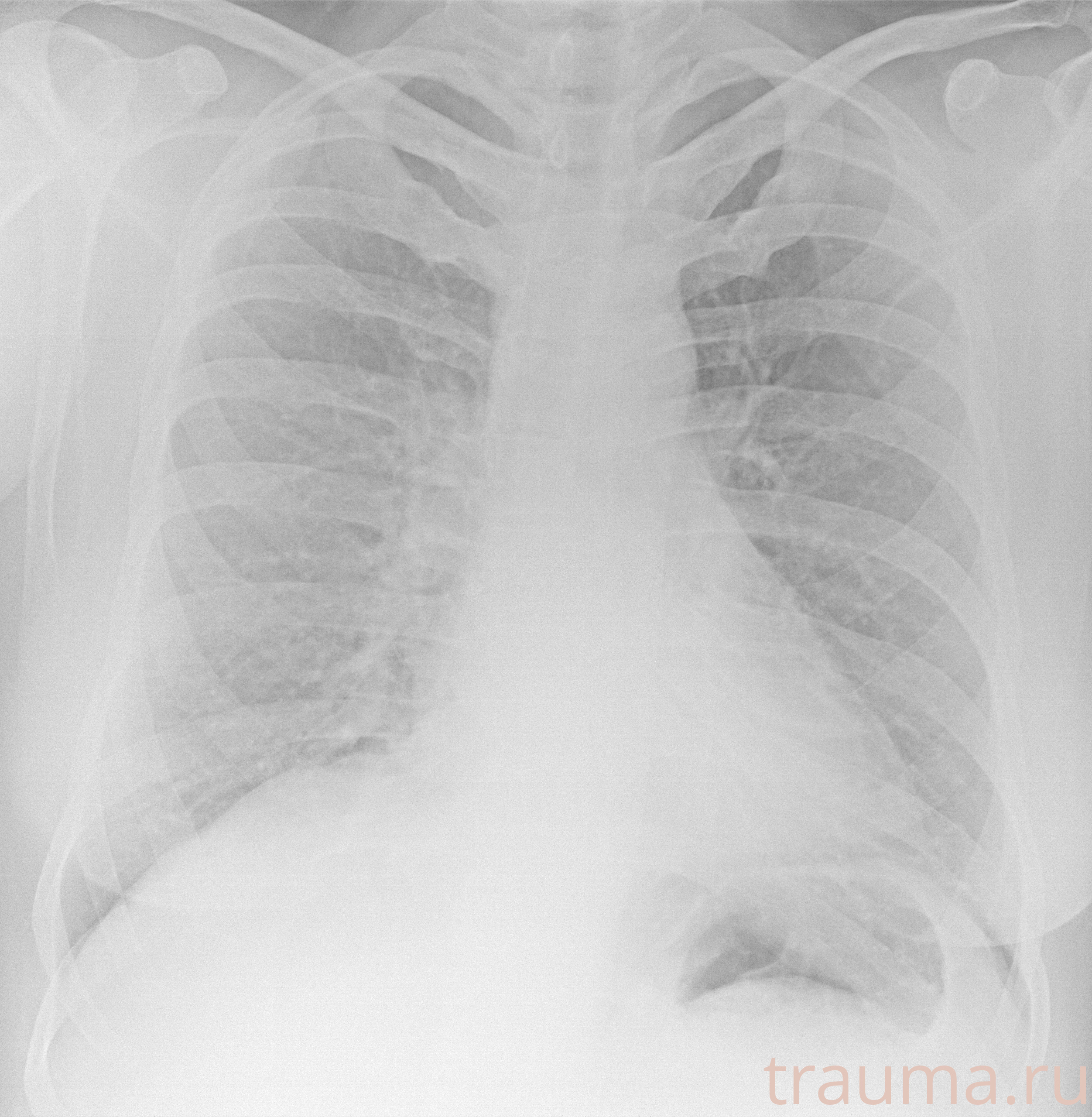 Рентген на дому: по вашему адресу приезжает врач-рентгенолог, травматолог-ортопед с мобильным рентгеновским аппаратом, проводит диагностику травмы или заболевания, делает необходимые рентгенограммы, дает рекомендации по дальнейшему лечению. Получить качественные снимки в домашних условиях возможно благодаря уникальной методике, разработанной МосРентген Центром для института  Склифосовского