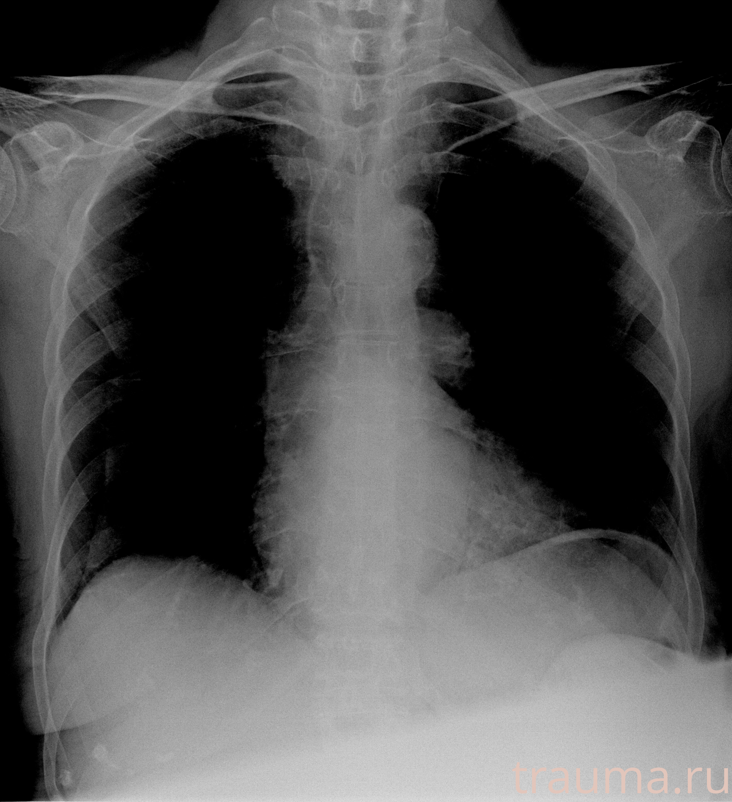 Рентген на дому: по вашему адресу приезжает врач-рентгенолог, травматолог-ортопед с мобильным рентгеновским аппаратом, проводит диагностику травмы или заболевания, делает необходимые рентгенограммы, дает рекомендации по дальнейшему лечению. Получить качественные снимки в домашних условиях возможно благодаря уникальной методике, разработанной МосРентген Центром для института  Склифосовского