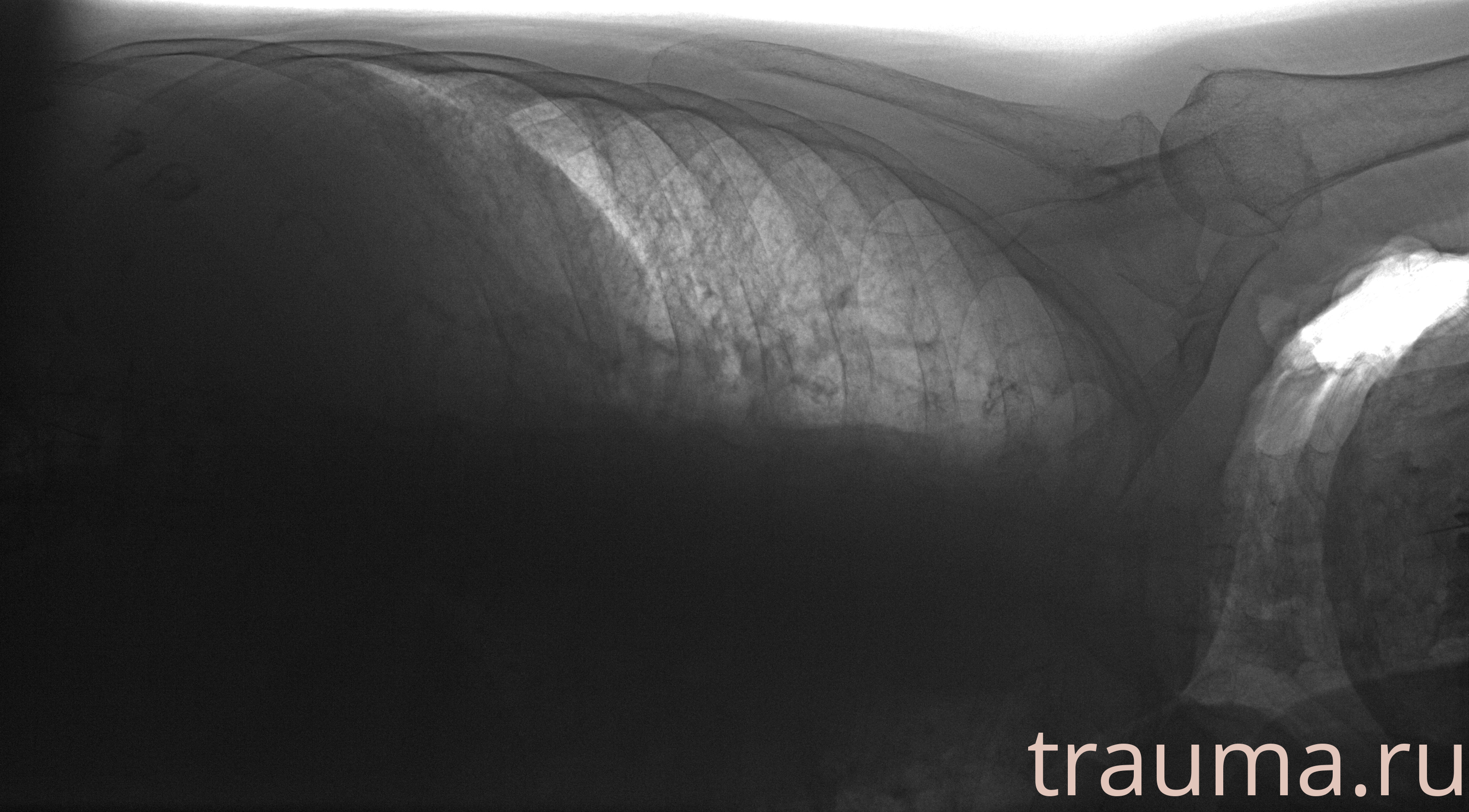 Рентген на дому: по вашему адресу приезжает врач-рентгенолог, травматолог-ортопед с мобильным рентгеновским аппаратом, проводит диагностику травмы или заболевания, делает необходимые рентгенограммы, дает рекомендации по дальнейшему лечению. Получить качественные снимки в домашних условиях возможно благодаря уникальной методике, разработанной МосРентген Центром для института  Склифосовского