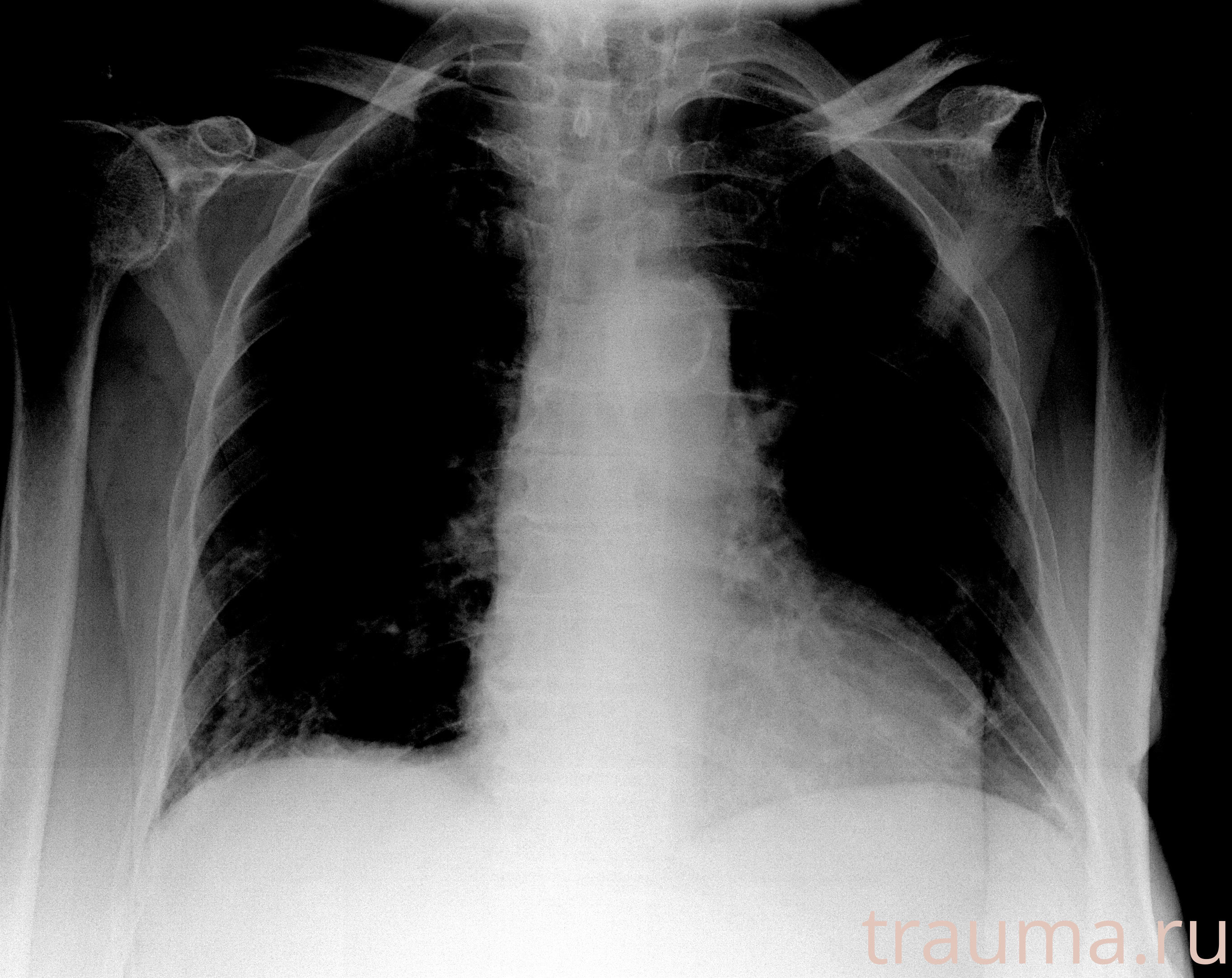 Рентген на дому: по вашему адресу приезжает врач-рентгенолог, травматолог-ортопед с мобильным рентгеновским аппаратом, проводит диагностику травмы или заболевания, делает необходимые рентгенограммы, дает рекомендации по дальнейшему лечению. Получить качественные снимки в домашних условиях возможно благодаря уникальной методике, разработанной МосРентген Центром для института  Склифосовского