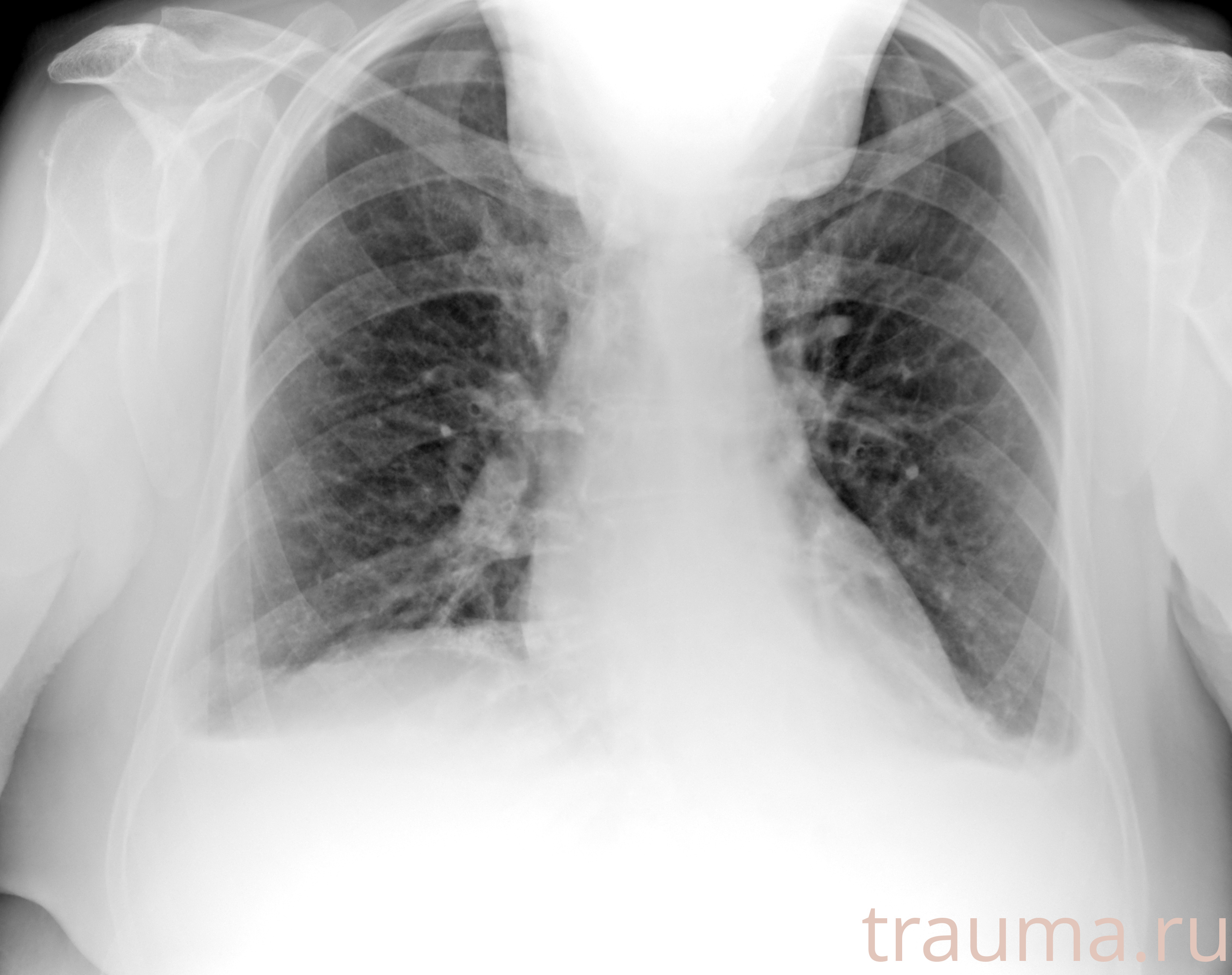 Рентген на дому: по вашему адресу приезжает врач-рентгенолог, травматолог-ортопед с мобильным рентгеновским аппаратом, проводит диагностику травмы или заболевания, делает необходимые рентгенограммы, дает рекомендации по дальнейшему лечению. Получить качественные снимки в домашних условиях возможно благодаря уникальной методике, разработанной МосРентген Центром для института  Склифосовского