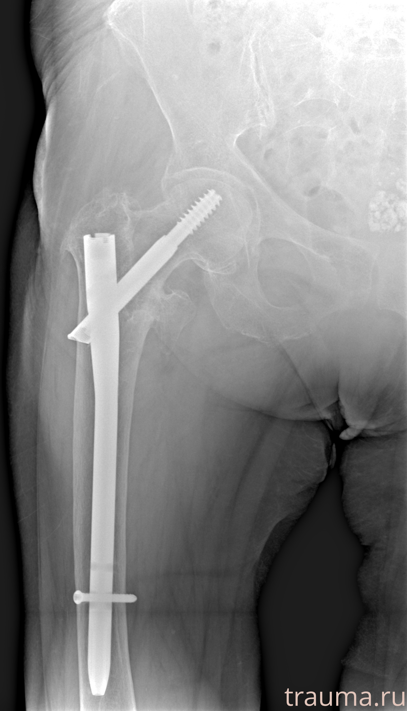 Рентген на дому: по вашему адресу приезжает врач-рентгенолог, травматолог-ортопед с мобильным рентгеновским аппаратом, проводит диагностику травмы или заболевания, делает необходимые рентгенограммы, дает рекомендации по дальнейшему лечению. Получить качественные снимки в домашних условиях возможно благодаря уникальной методике, разработанной МосРентген Центром для института  Склифосовского