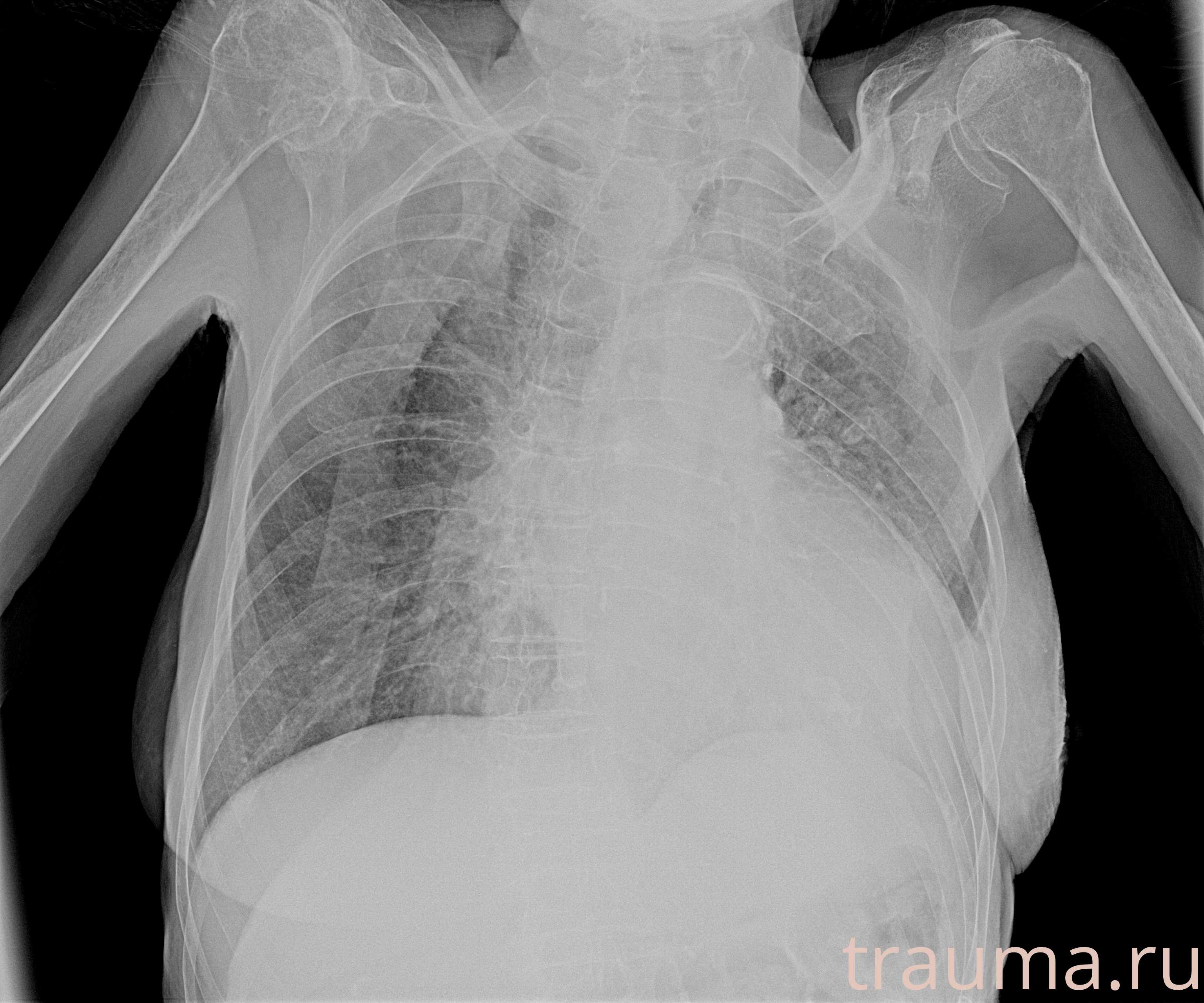 Рентген на дому: по вашему адресу приезжает врач-рентгенолог, травматолог-ортопед с мобильным рентгеновским аппаратом, проводит диагностику травмы или заболевания, делает необходимые рентгенограммы, дает рекомендации по дальнейшему лечению. Получить качественные снимки в домашних условиях возможно благодаря уникальной методике, разработанной МосРентген Центром для института  Склифосовского