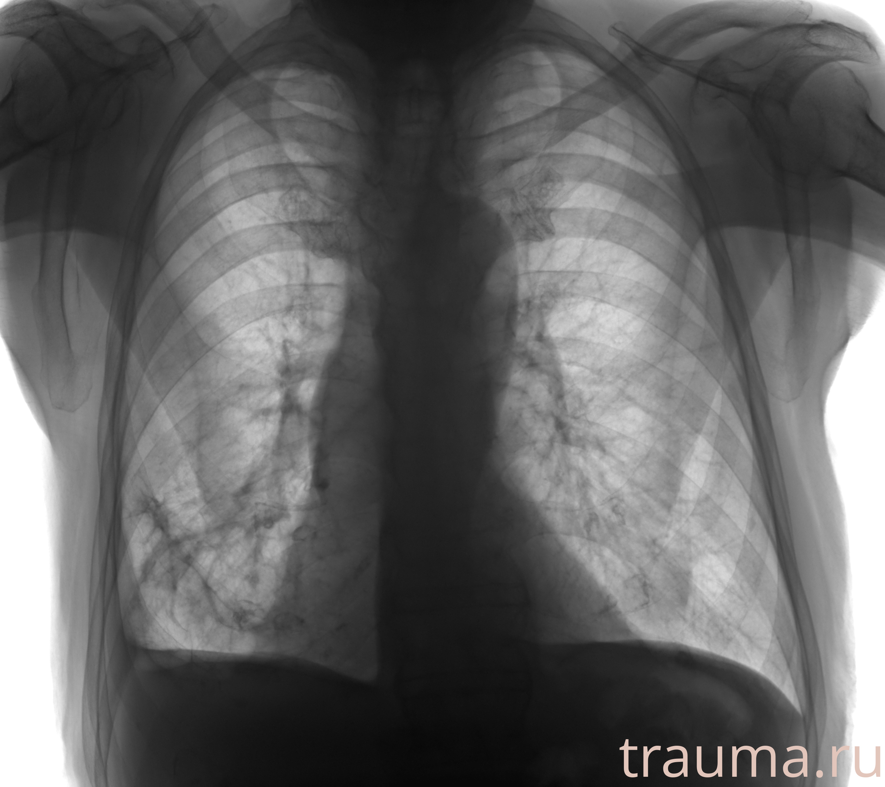 Рентген на дому: по вашему адресу приезжает врач-рентгенолог, травматолог-ортопед с мобильным рентгеновским аппаратом, проводит диагностику травмы или заболевания, делает необходимые рентгенограммы, дает рекомендации по дальнейшему лечению. Получить качественные снимки в домашних условиях возможно благодаря уникальной методике, разработанной МосРентген Центром для института  Склифосовского