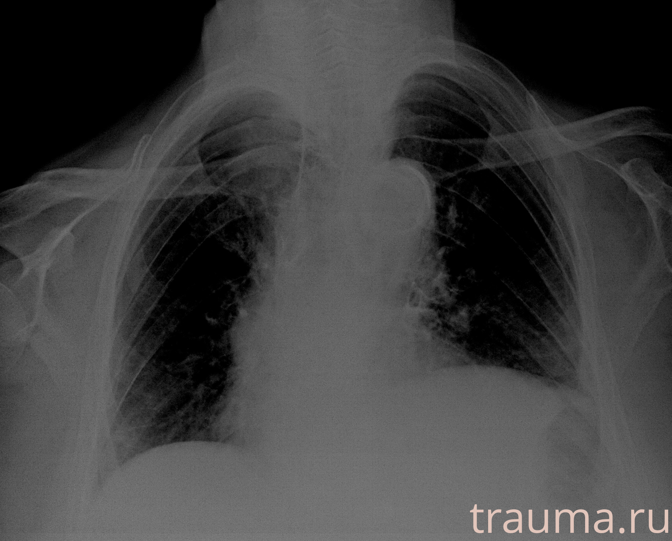Рентген на дому: по вашему адресу приезжает врач-рентгенолог, травматолог-ортопед с мобильным рентгеновским аппаратом, проводит диагностику травмы или заболевания, делает необходимые рентгенограммы, дает рекомендации по дальнейшему лечению. Получить качественные снимки в домашних условиях возможно благодаря уникальной методике, разработанной МосРентген Центром для института  Склифосовского