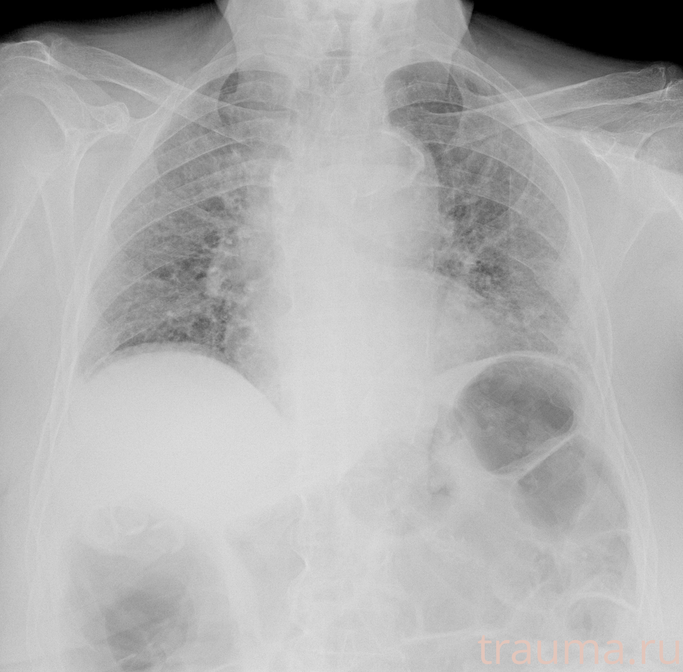 Рентген на дому: по вашему адресу приезжает врач-рентгенолог, травматолог-ортопед с мобильным рентгеновским аппаратом, проводит диагностику травмы или заболевания, делает необходимые рентгенограммы, дает рекомендации по дальнейшему лечению. Получить качественные снимки в домашних условиях возможно благодаря уникальной методике, разработанной МосРентген Центром для института  Склифосовского