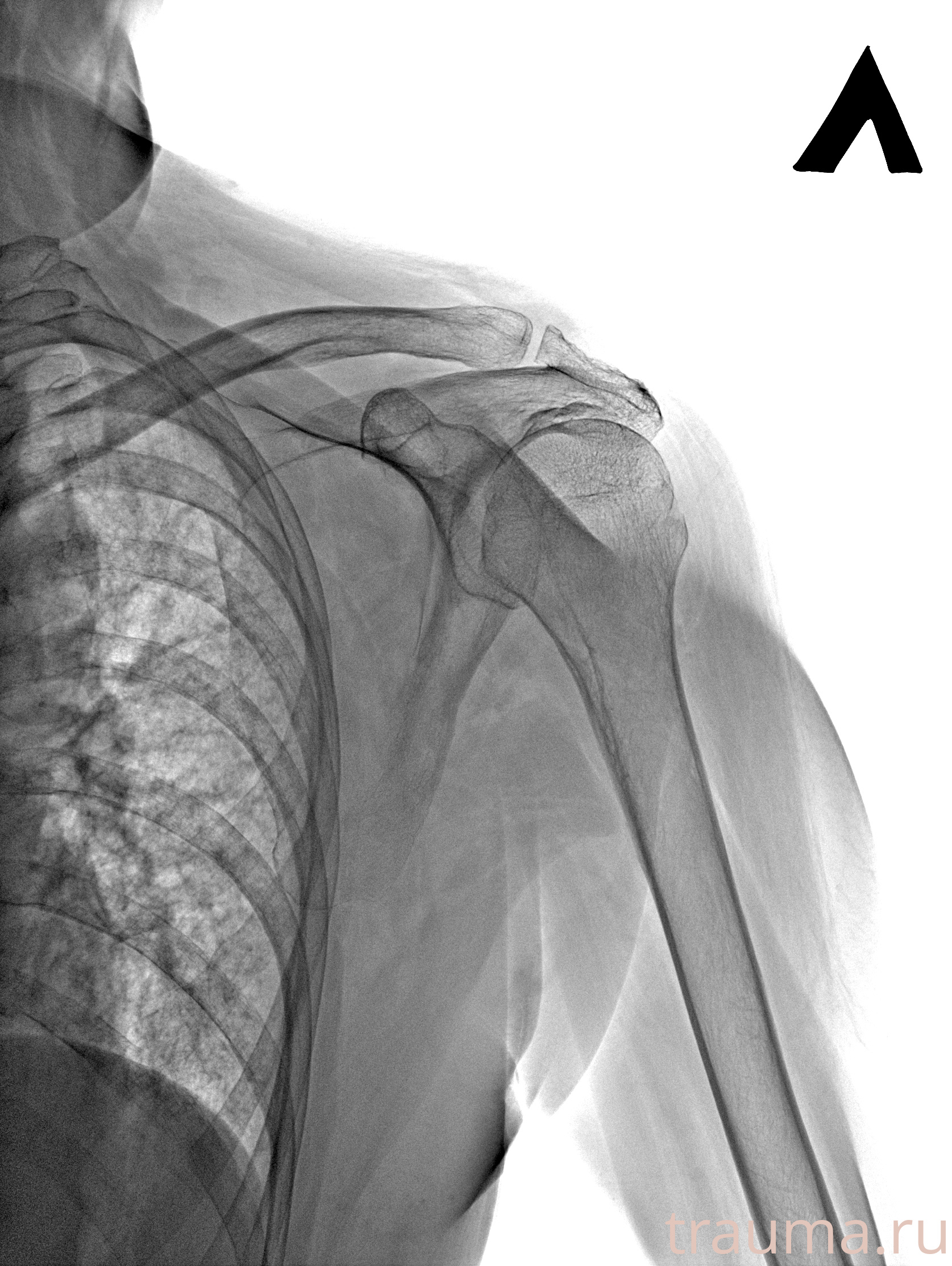 Рентген на дому: по вашему адресу приезжает врач-рентгенолог, травматолог-ортопед с мобильным рентгеновским аппаратом, проводит диагностику травмы или заболевания, делает необходимые рентгенограммы, дает рекомендации по дальнейшему лечению. Получить качественные снимки в домашних условиях возможно благодаря уникальной методике, разработанной МосРентген Центром для института  Склифосовского