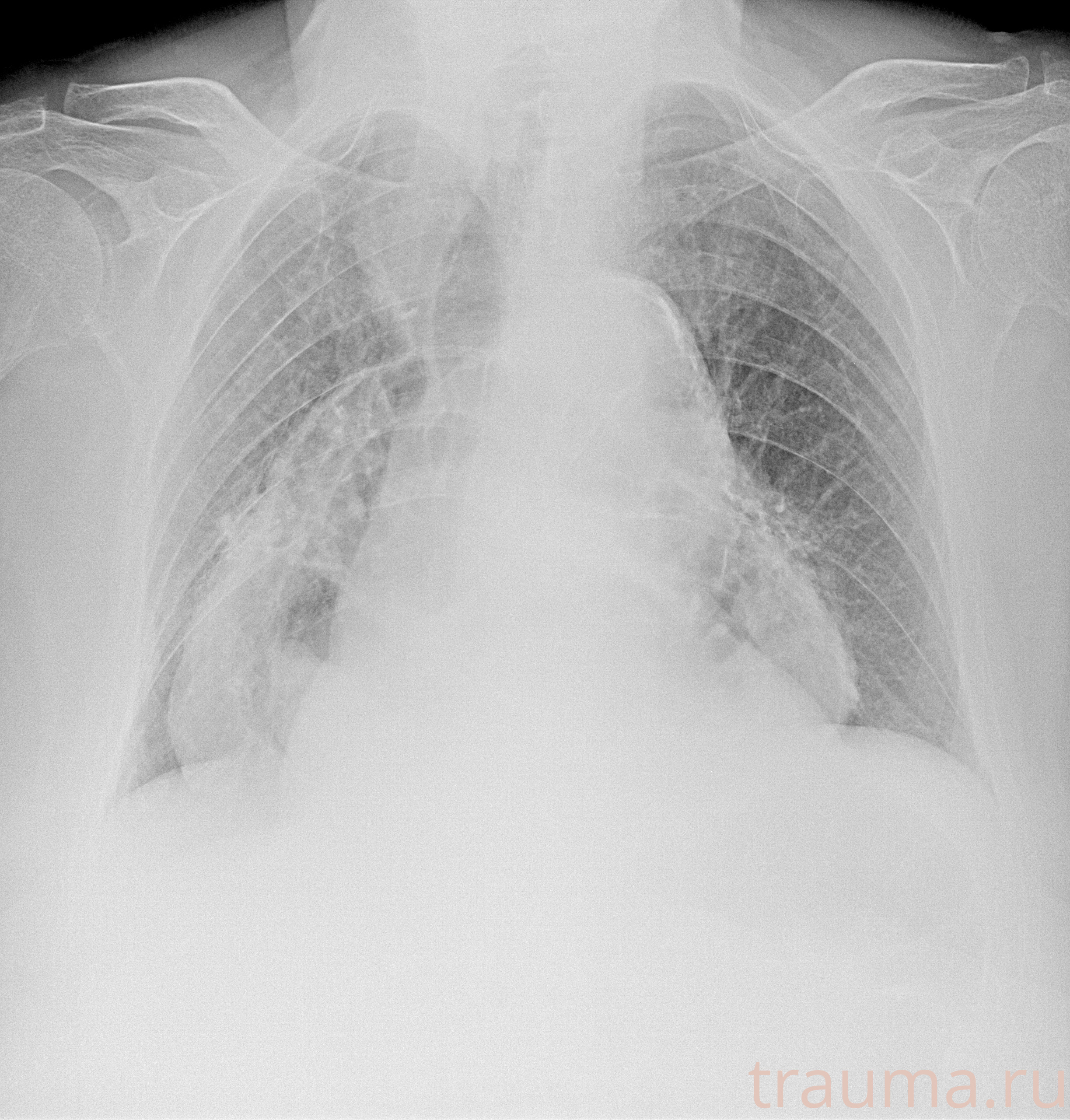 Рентген на дому: по вашему адресу приезжает врач-рентгенолог, травматолог-ортопед с мобильным рентгеновским аппаратом, проводит диагностику травмы или заболевания, делает необходимые рентгенограммы, дает рекомендации по дальнейшему лечению. Получить качественные снимки в домашних условиях возможно благодаря уникальной методике, разработанной МосРентген Центром для института  Склифосовского