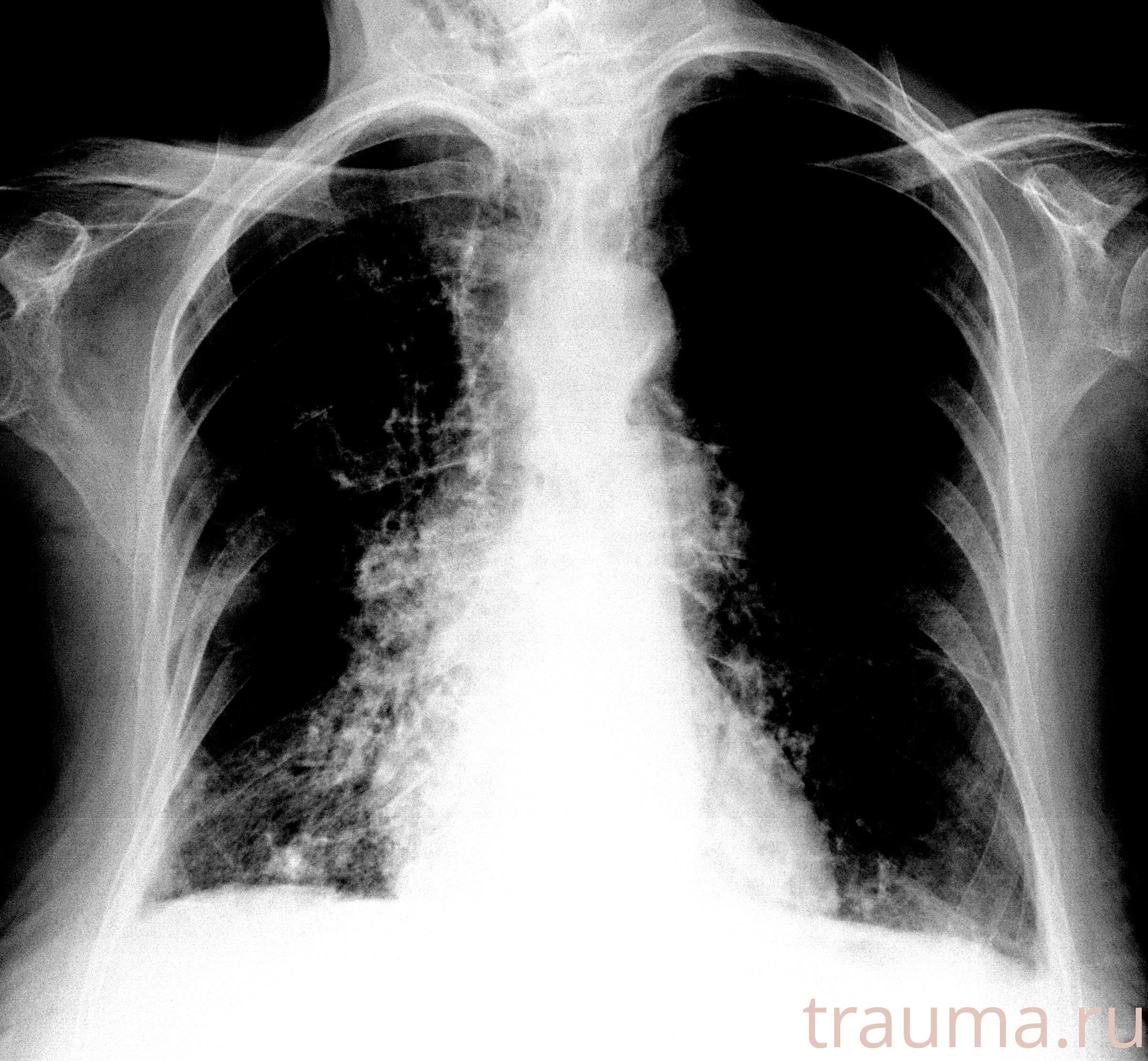 Рентген на дому: по вашему адресу приезжает врач-рентгенолог, травматолог-ортопед с мобильным рентгеновским аппаратом, проводит диагностику травмы или заболевания, делает необходимые рентгенограммы, дает рекомендации по дальнейшему лечению. Получить качественные снимки в домашних условиях возможно благодаря уникальной методике, разработанной МосРентген Центром для института  Склифосовского