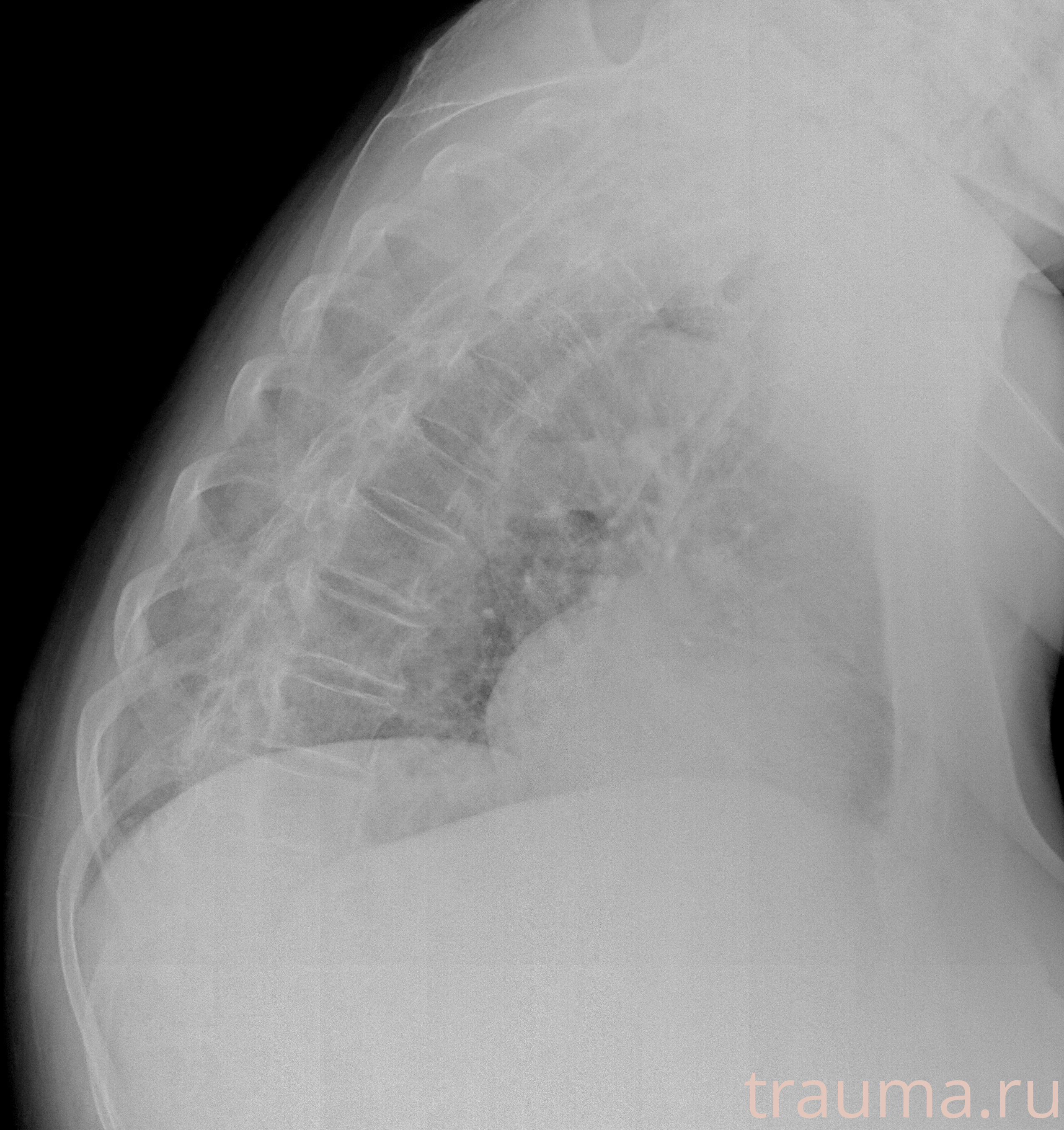 Рентген на дому: по вашему адресу приезжает врач-рентгенолог, травматолог-ортопед с мобильным рентгеновским аппаратом, проводит диагностику травмы или заболевания, делает необходимые рентгенограммы, дает рекомендации по дальнейшему лечению. Получить качественные снимки в домашних условиях возможно благодаря уникальной методике, разработанной МосРентген Центром для института  Склифосовского