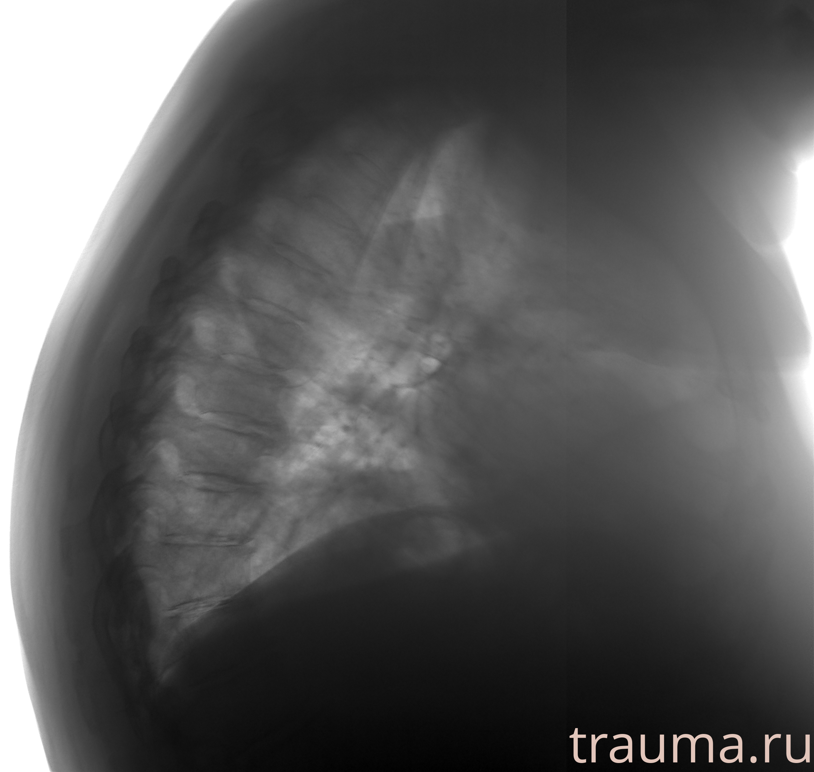 Рентген на дому: по вашему адресу приезжает врач-рентгенолог, травматолог-ортопед с мобильным рентгеновским аппаратом, проводит диагностику травмы или заболевания, делает необходимые рентгенограммы, дает рекомендации по дальнейшему лечению. Получить качественные снимки в домашних условиях возможно благодаря уникальной методике, разработанной МосРентген Центром для института  Склифосовского