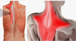 Применение непрямой лимфотропной терапии при гнойно-воспалительных заболеваниях предплечья Применение непрямой лимфотропной терапии при гнойно-воспалительных заболеваниях предплечья