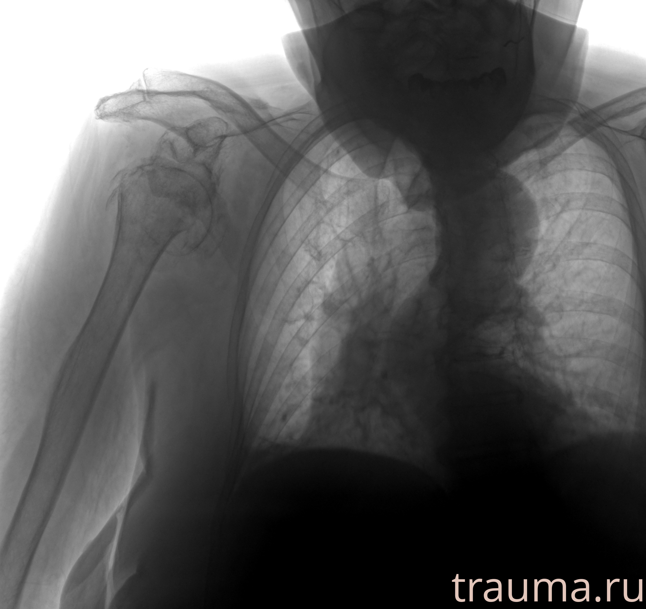 Рентген на дому: по вашему адресу приезжает врач-рентгенолог, травматолог-ортопед с мобильным рентгеновским аппаратом, проводит диагностику травмы или заболевания, делает необходимые рентгенограммы, дает рекомендации по дальнейшему лечению. Получить качественные снимки в домашних условиях возможно благодаря уникальной методике, разработанной МосРентген Центром для института  Склифосовского