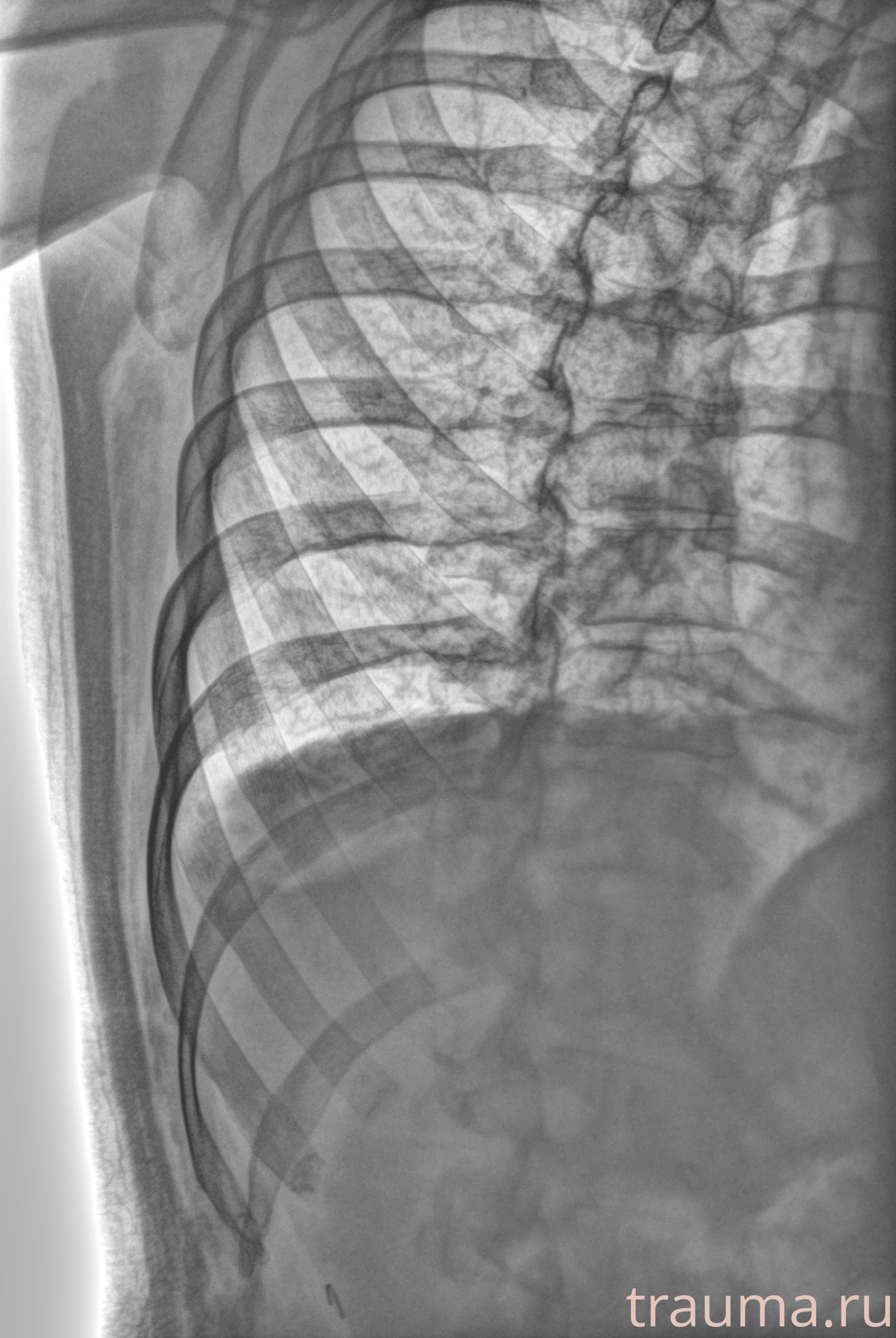 Рентген на дому: по вашему адресу приезжает врач-рентгенолог, травматолог-ортопед с мобильным рентгеновским аппаратом, проводит диагностику травмы или заболевания, делает необходимые рентгенограммы, дает рекомендации по дальнейшему лечению. Получить качественные снимки в домашних условиях возможно благодаря уникальной методике, разработанной МосРентген Центром для института  Склифосовского