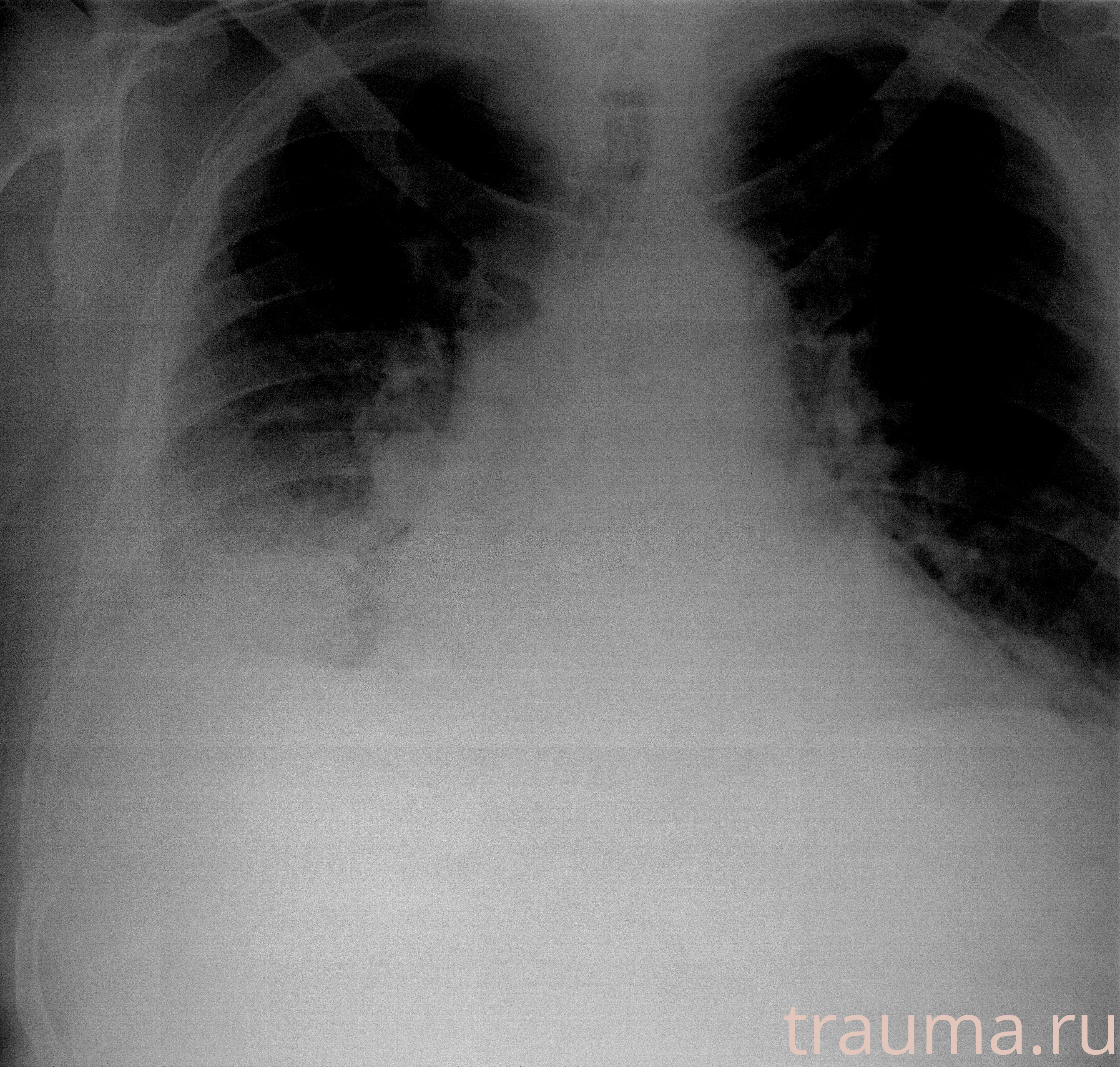 Рентген на дому: по вашему адресу приезжает врач-рентгенолог, травматолог-ортопед с мобильным рентгеновским аппаратом, проводит диагностику травмы или заболевания, делает необходимые рентгенограммы, дает рекомендации по дальнейшему лечению. Получить качественные снимки в домашних условиях возможно благодаря уникальной методике, разработанной МосРентген Центром для института  Склифосовского