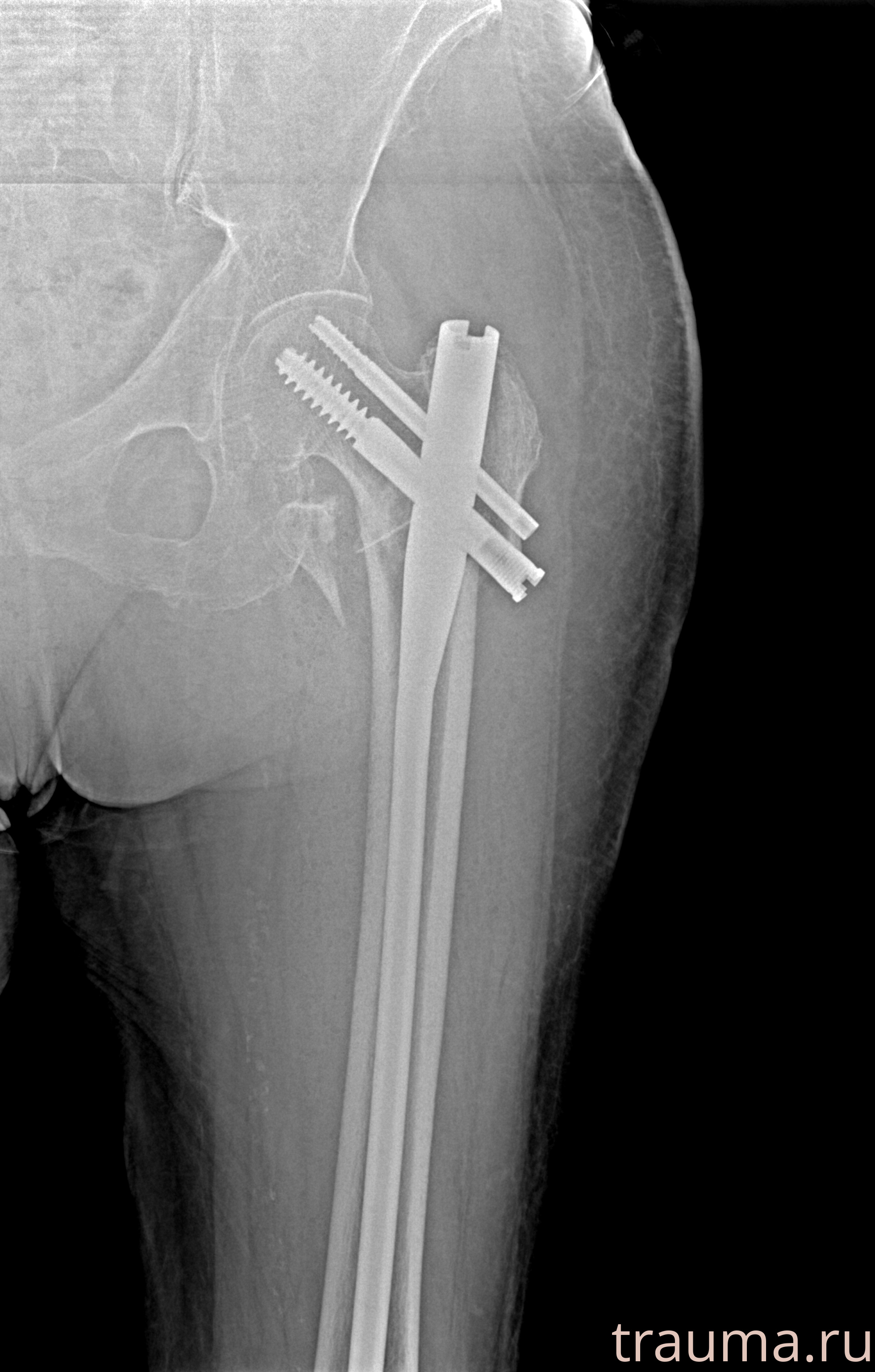 Рентген на дому: по вашему адресу приезжает врач-рентгенолог, травматолог-ортопед с мобильным рентгеновским аппаратом, проводит диагностику травмы или заболевания, делает необходимые рентгенограммы, дает рекомендации по дальнейшему лечению. Получить качественные снимки в домашних условиях возможно благодаря уникальной методике, разработанной МосРентген Центром для института  Склифосовского